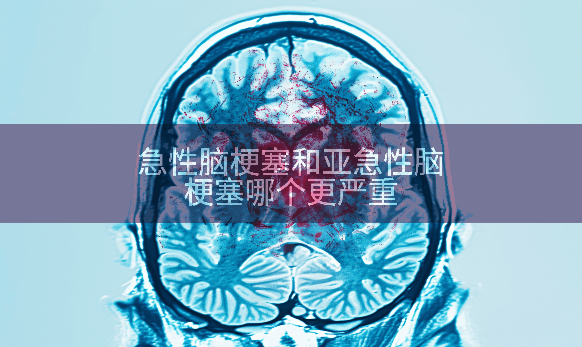 急性脑梗塞和亚急性脑梗塞哪个更严重