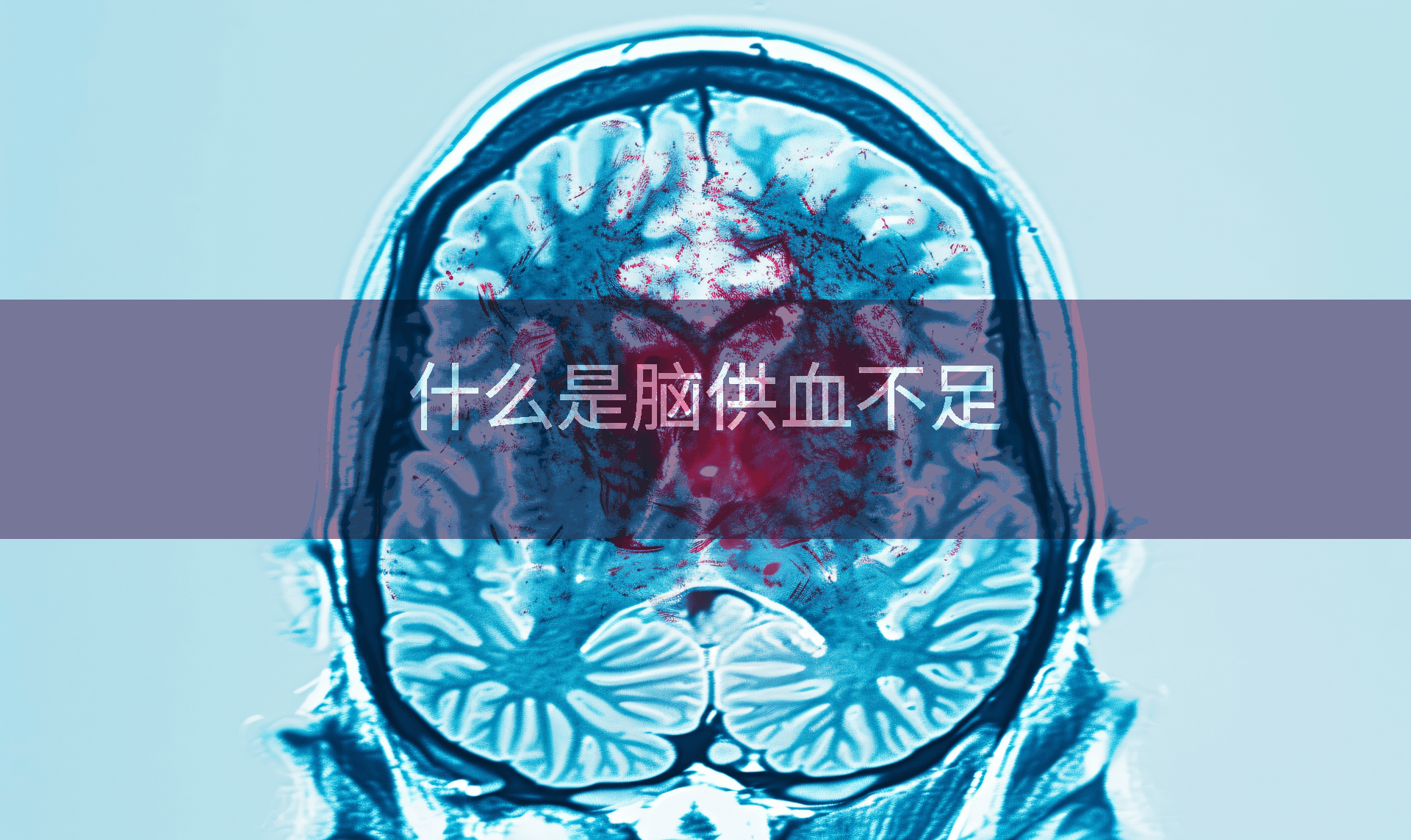 什么是脑供血不足