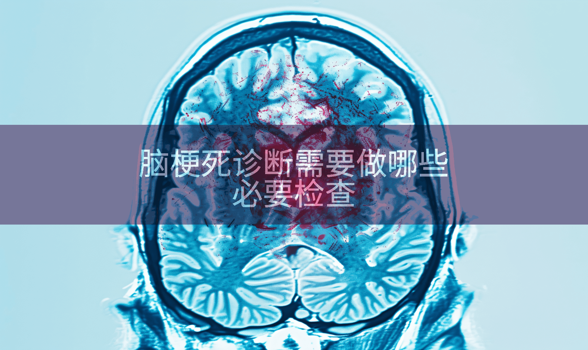 脑梗死诊断需要做哪些必要检查