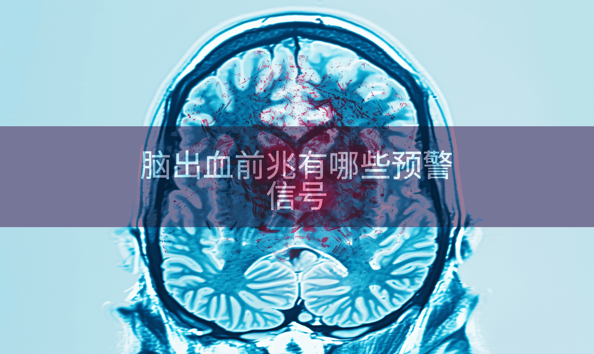 脑出血前兆有哪些预警信号