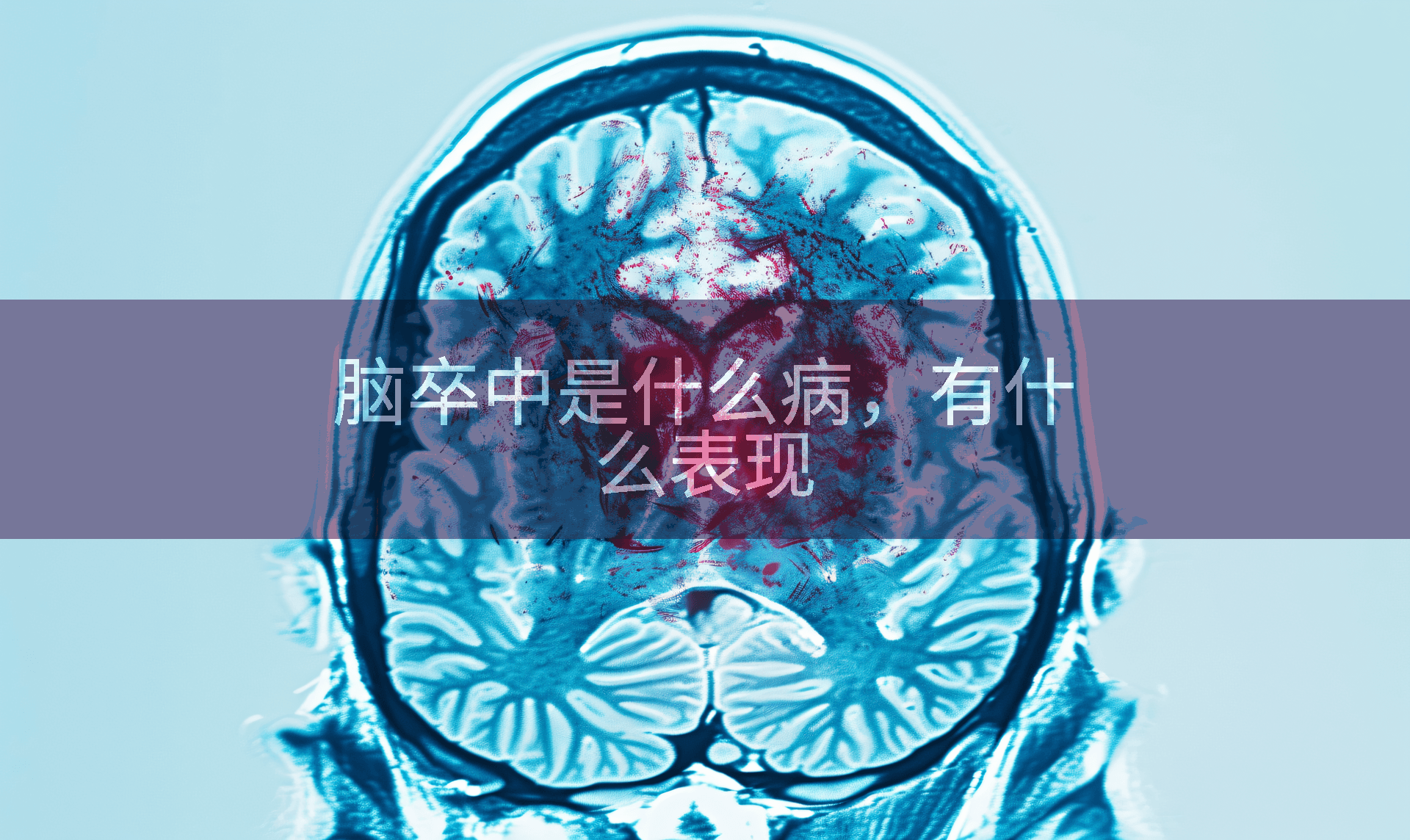 脑卒中是什么病，有什么表现