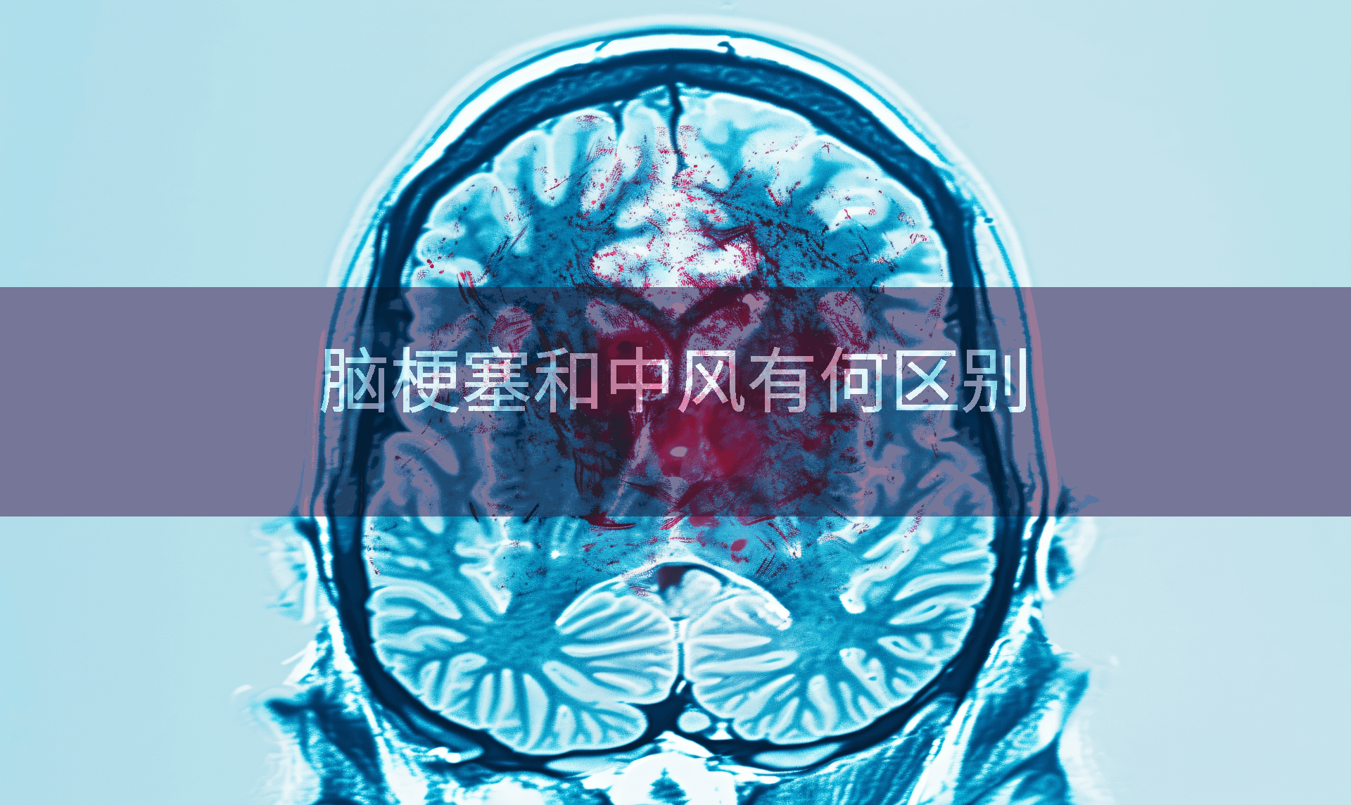脑梗塞和中风有何区别