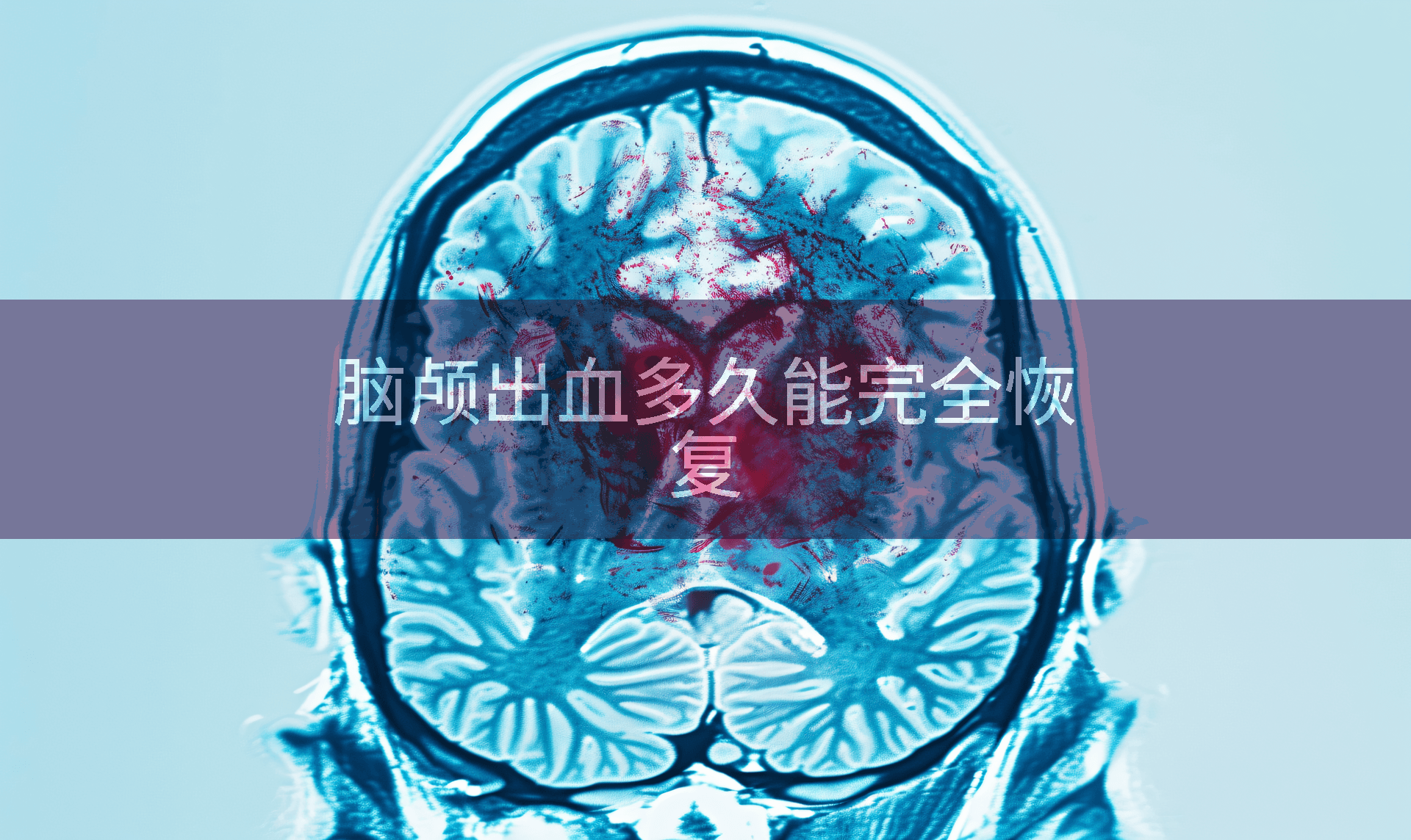 脑颅出血多久能完全恢复
