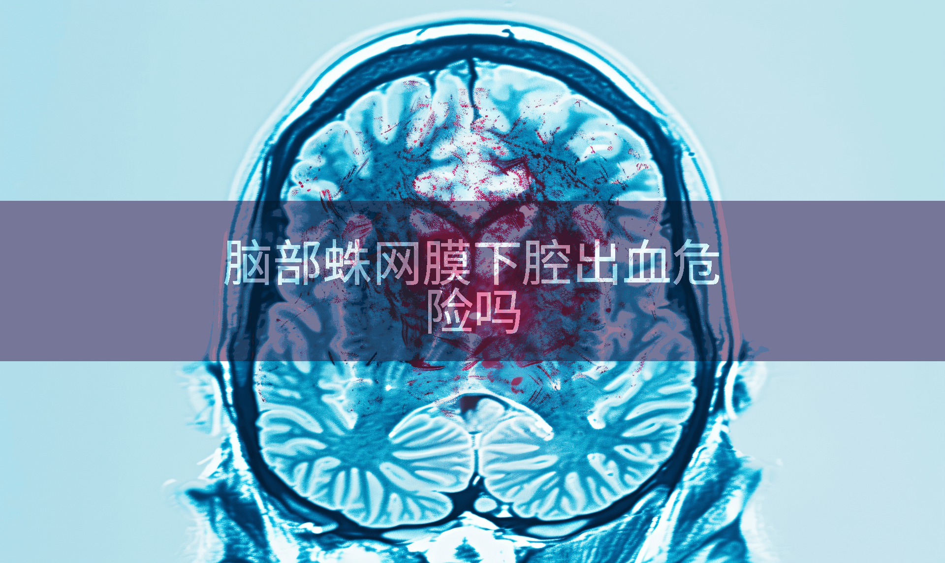 脑部蛛网膜下腔出血危险吗