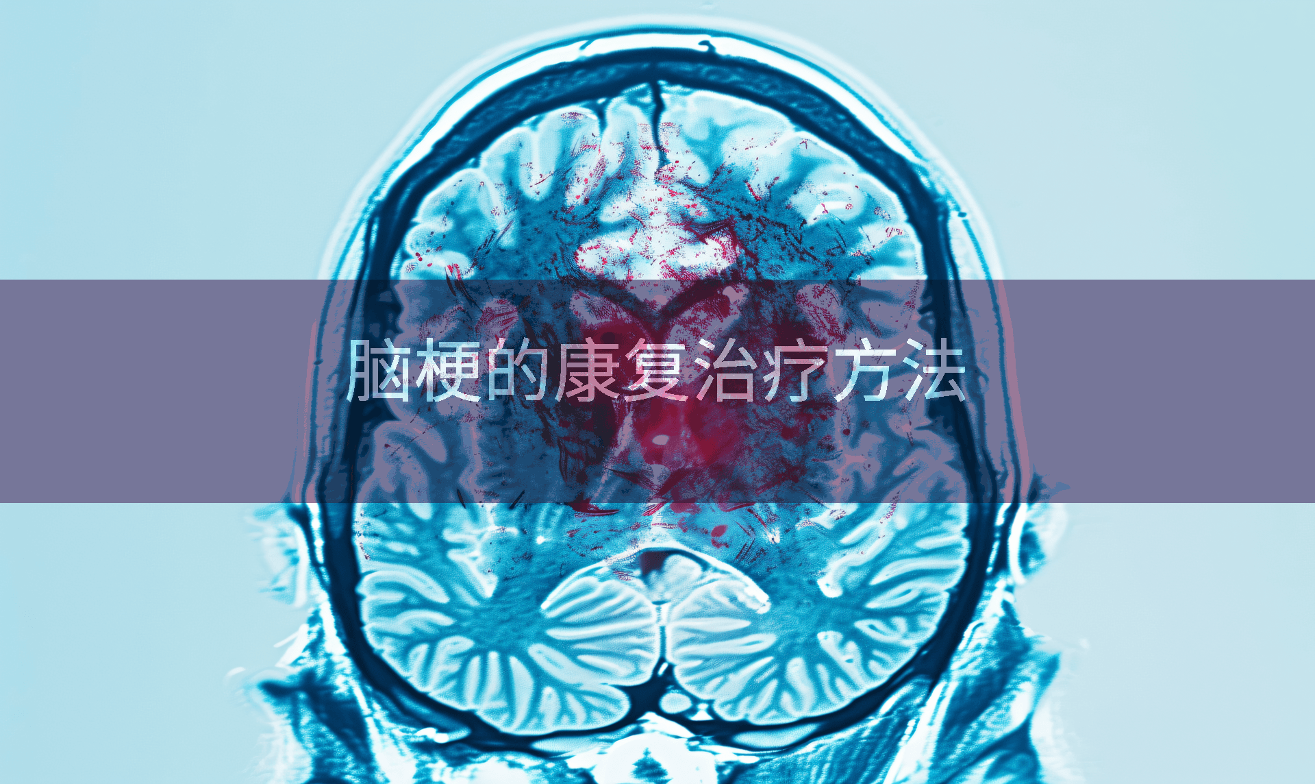 脑梗的康复治疗方法