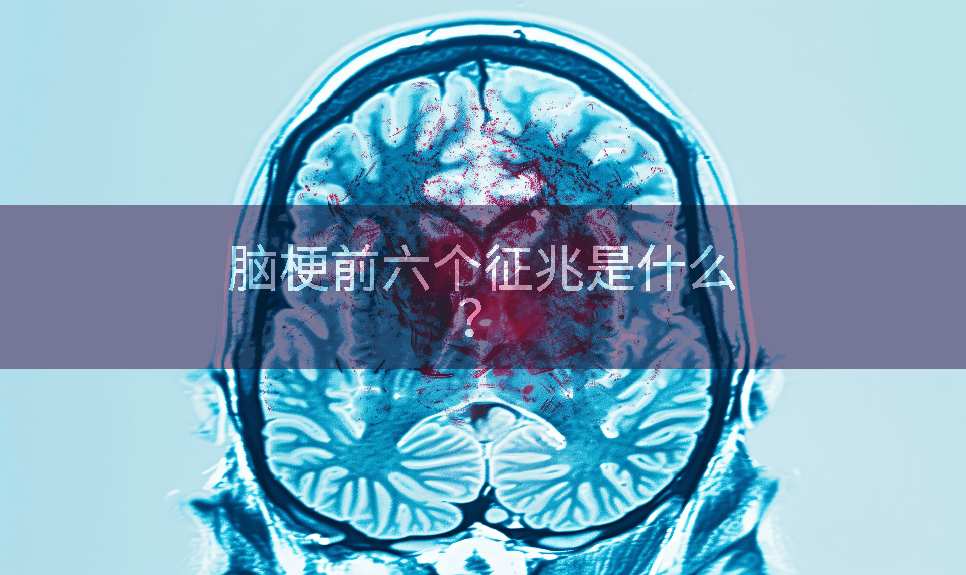 脑梗前六个征兆是什么？