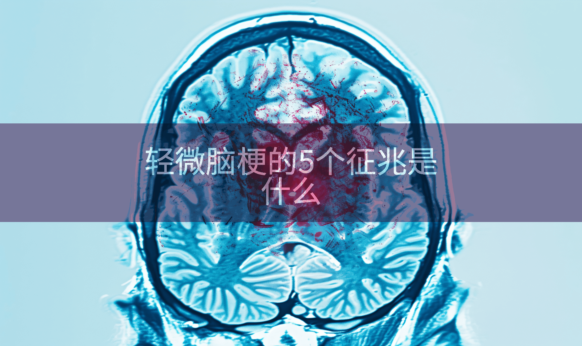 轻微脑梗的5个征兆是什么