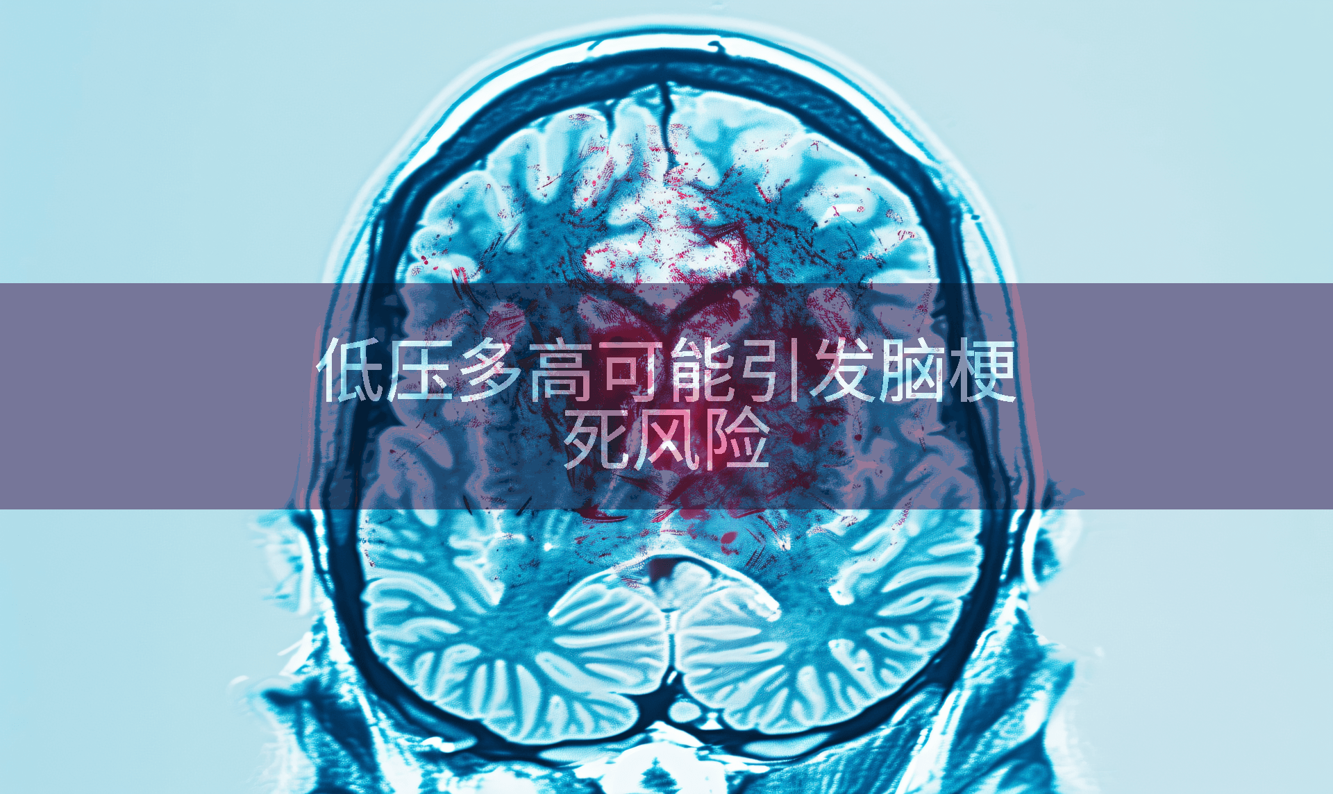 低压多高可能引发脑梗死风险