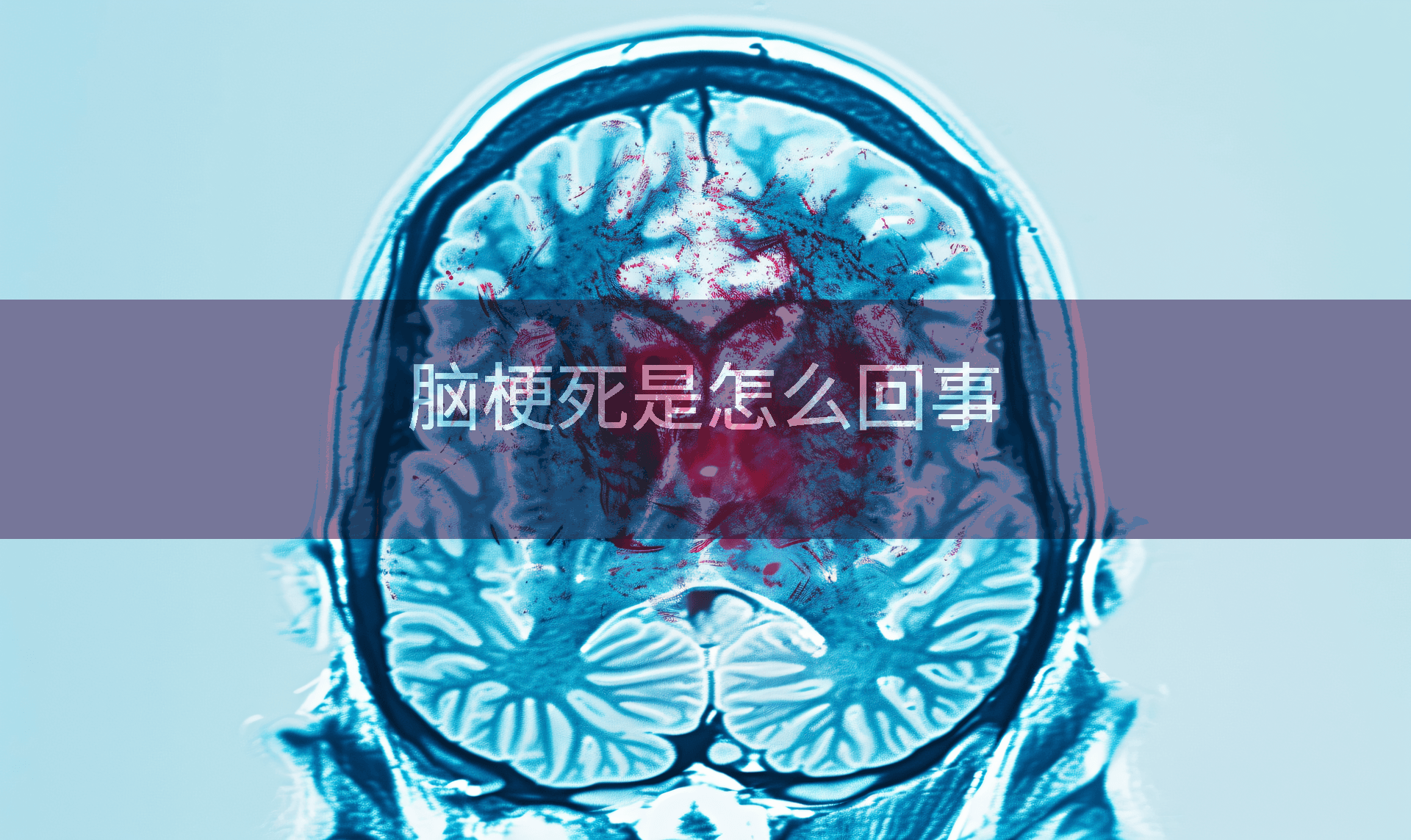 脑梗死是怎么回事