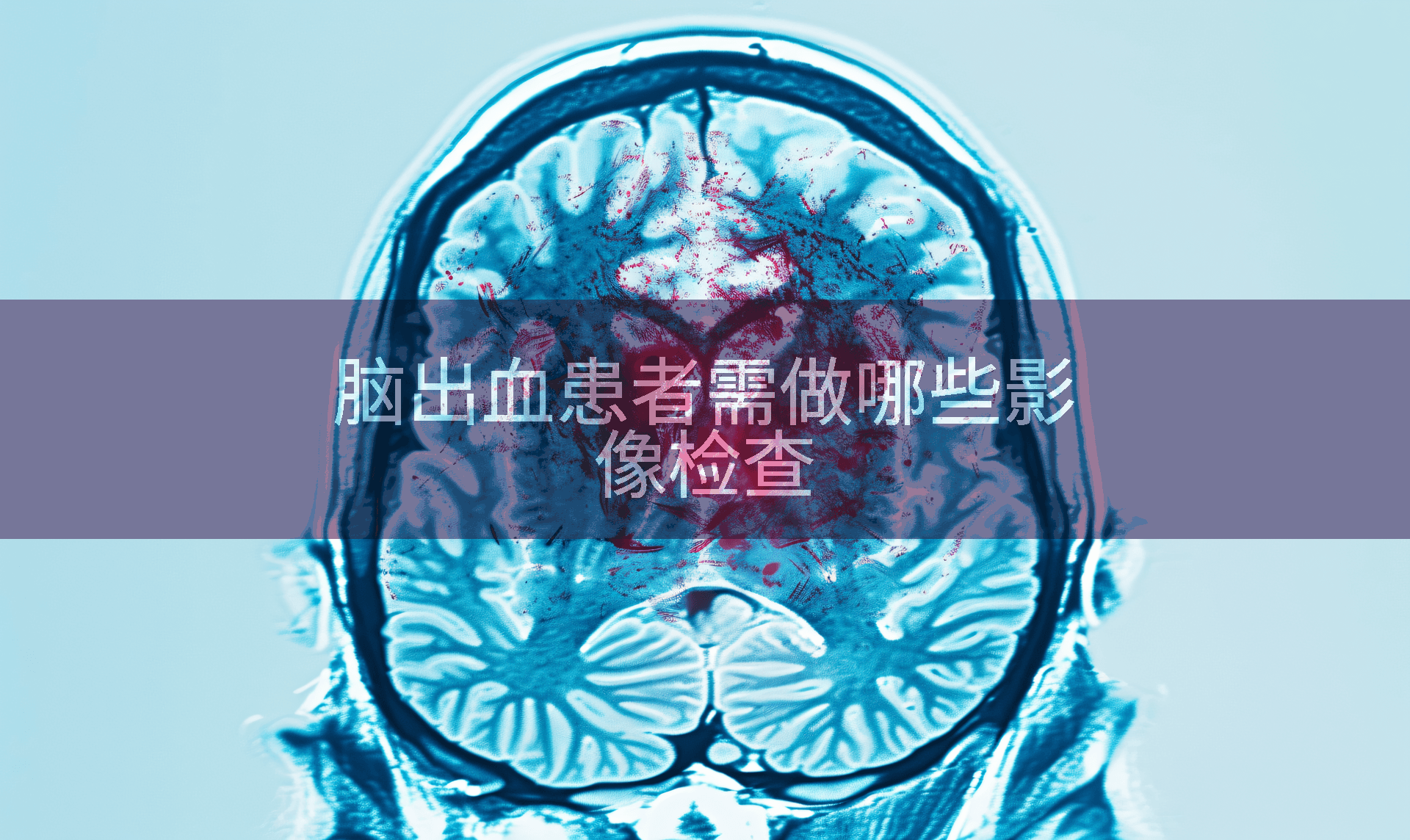 脑出血患者需做哪些影像检查