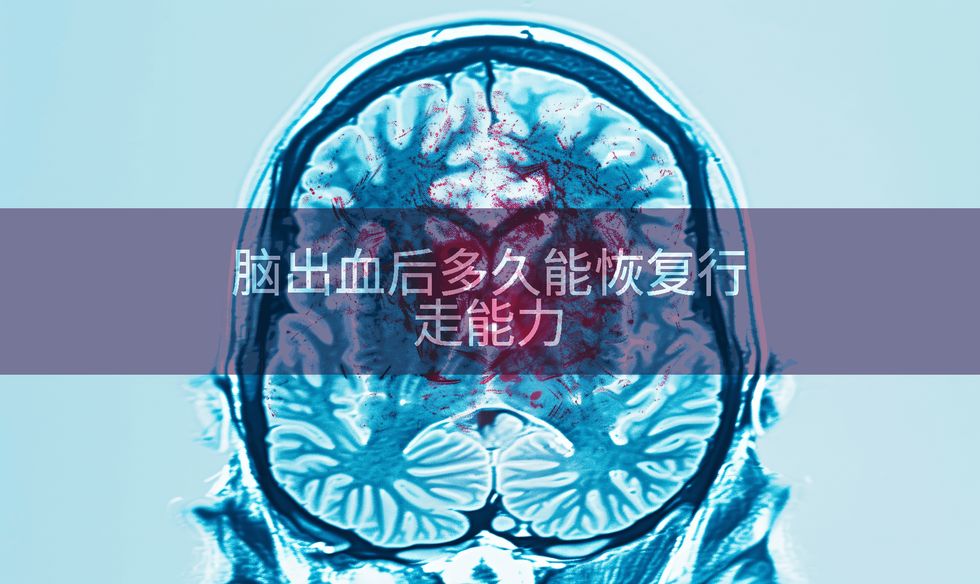 脑出血后多久能恢复行走能力