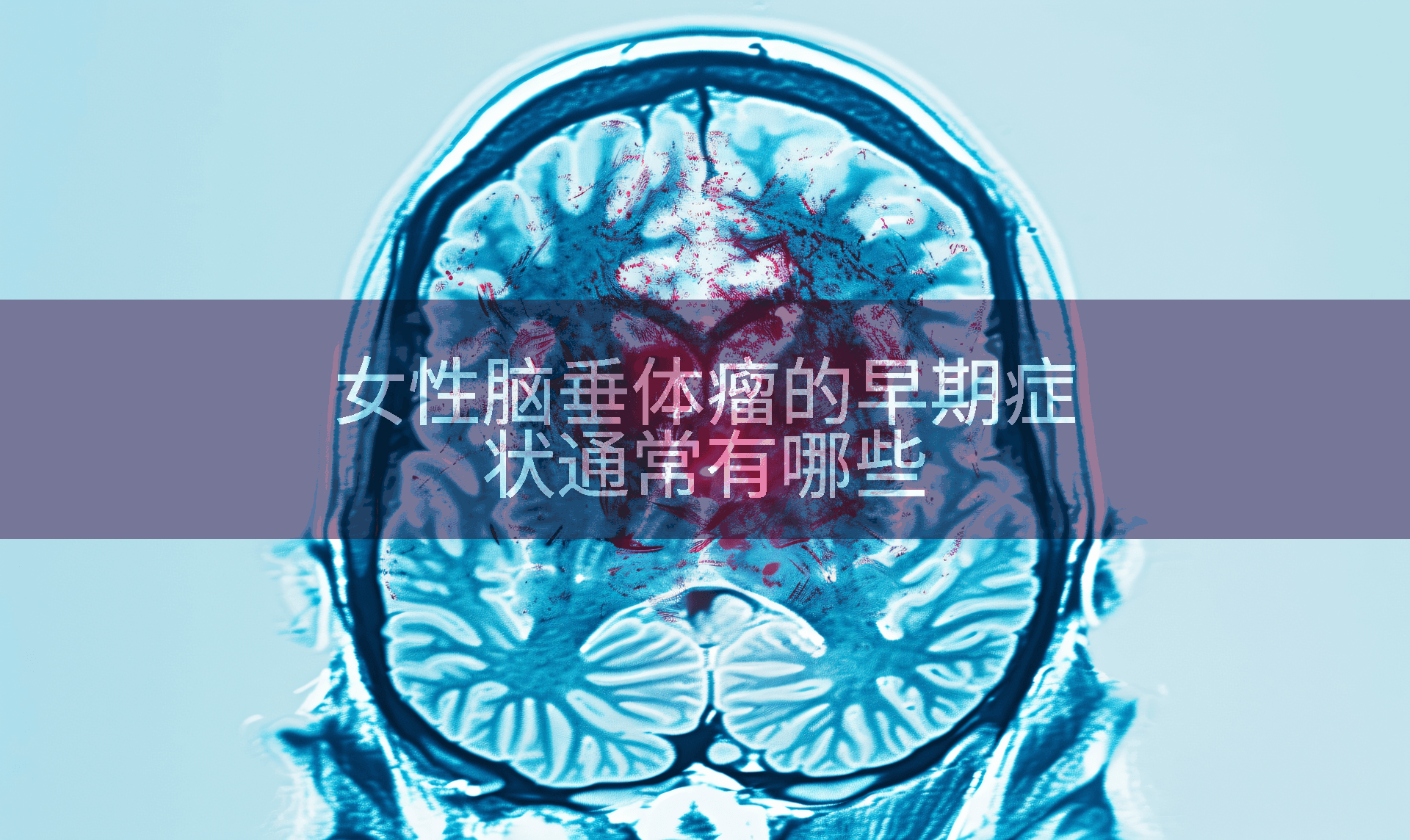 女性脑垂体瘤的早期症状通常有哪些