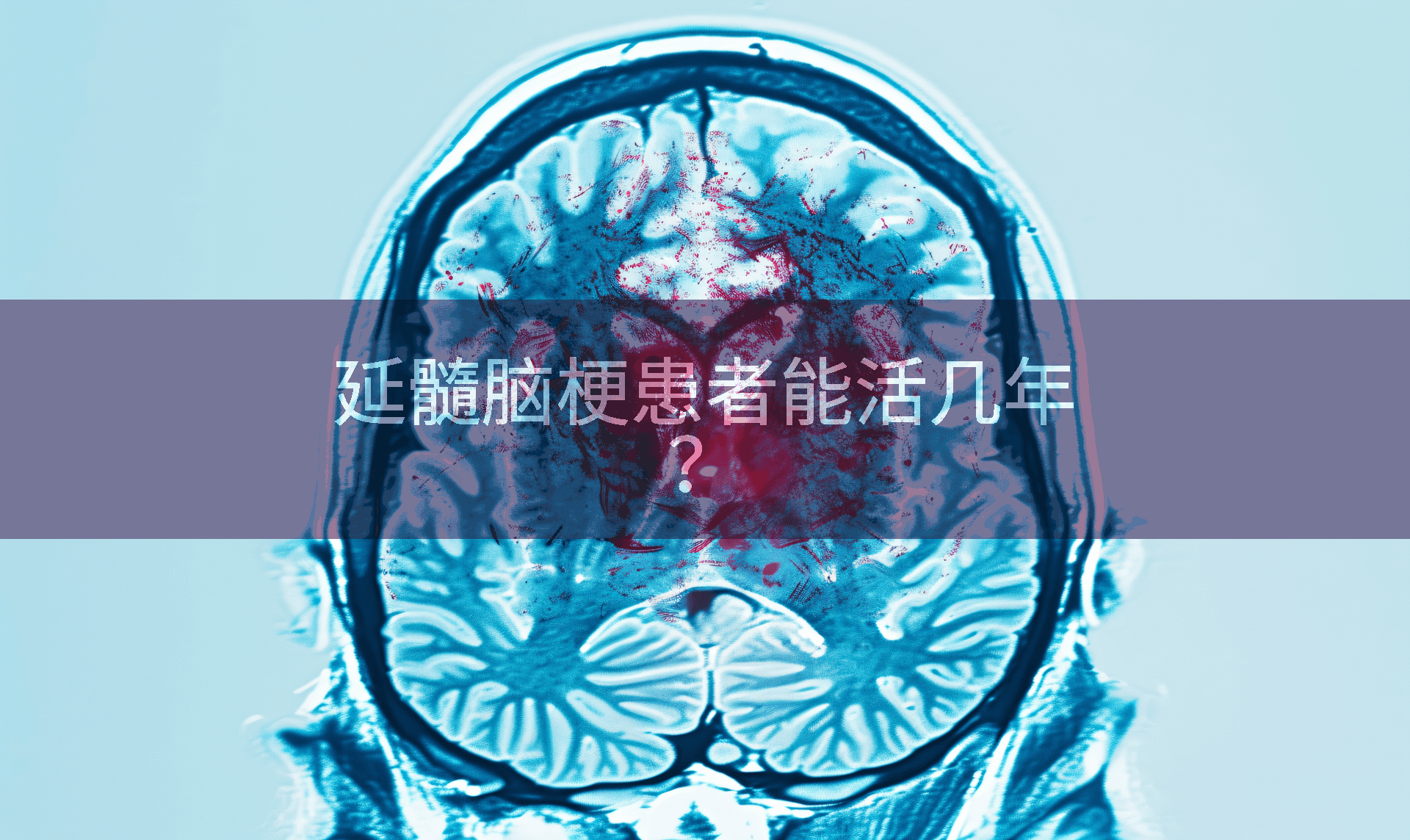 延髓脑梗患者能活几年？