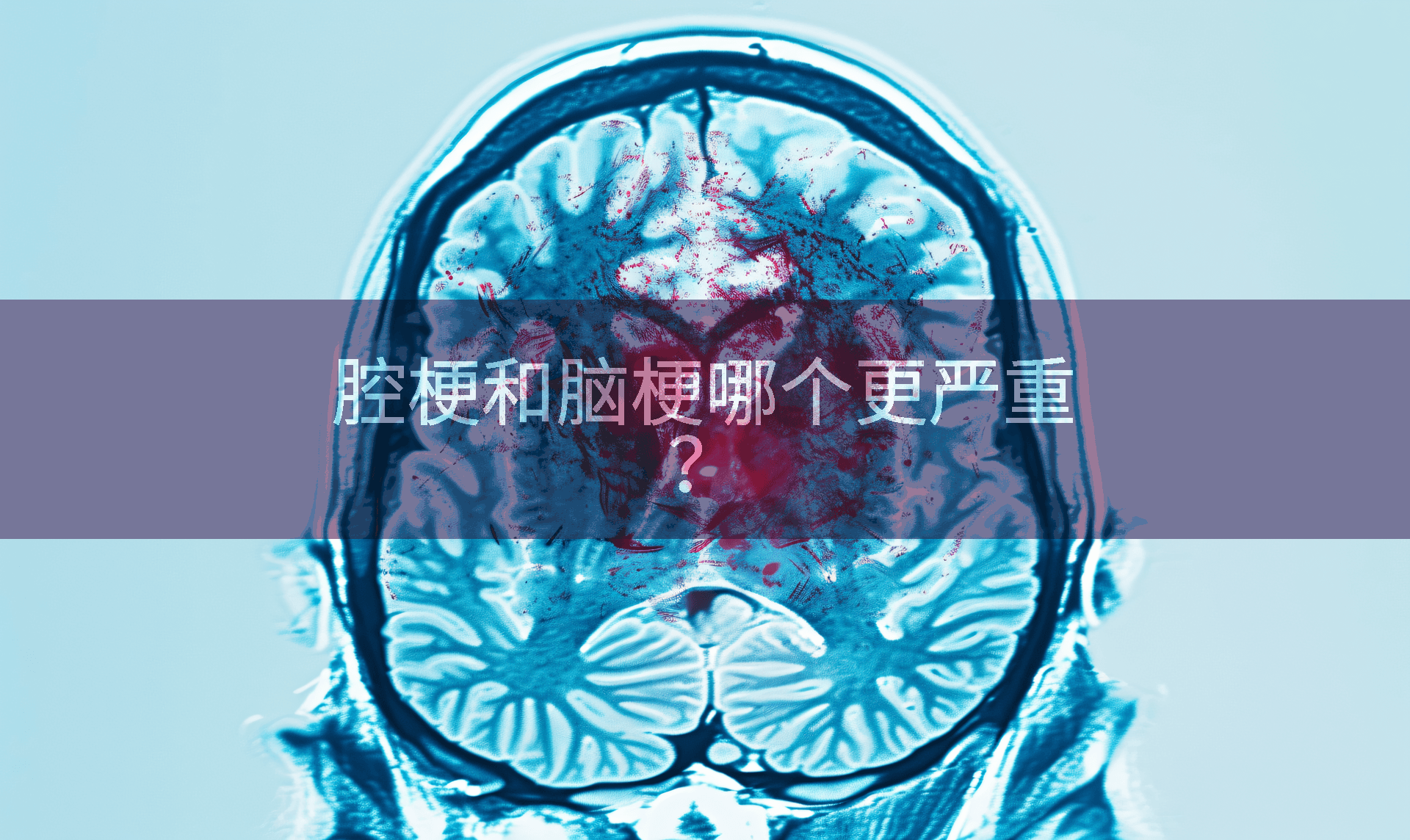腔梗和脑梗哪个更严重？