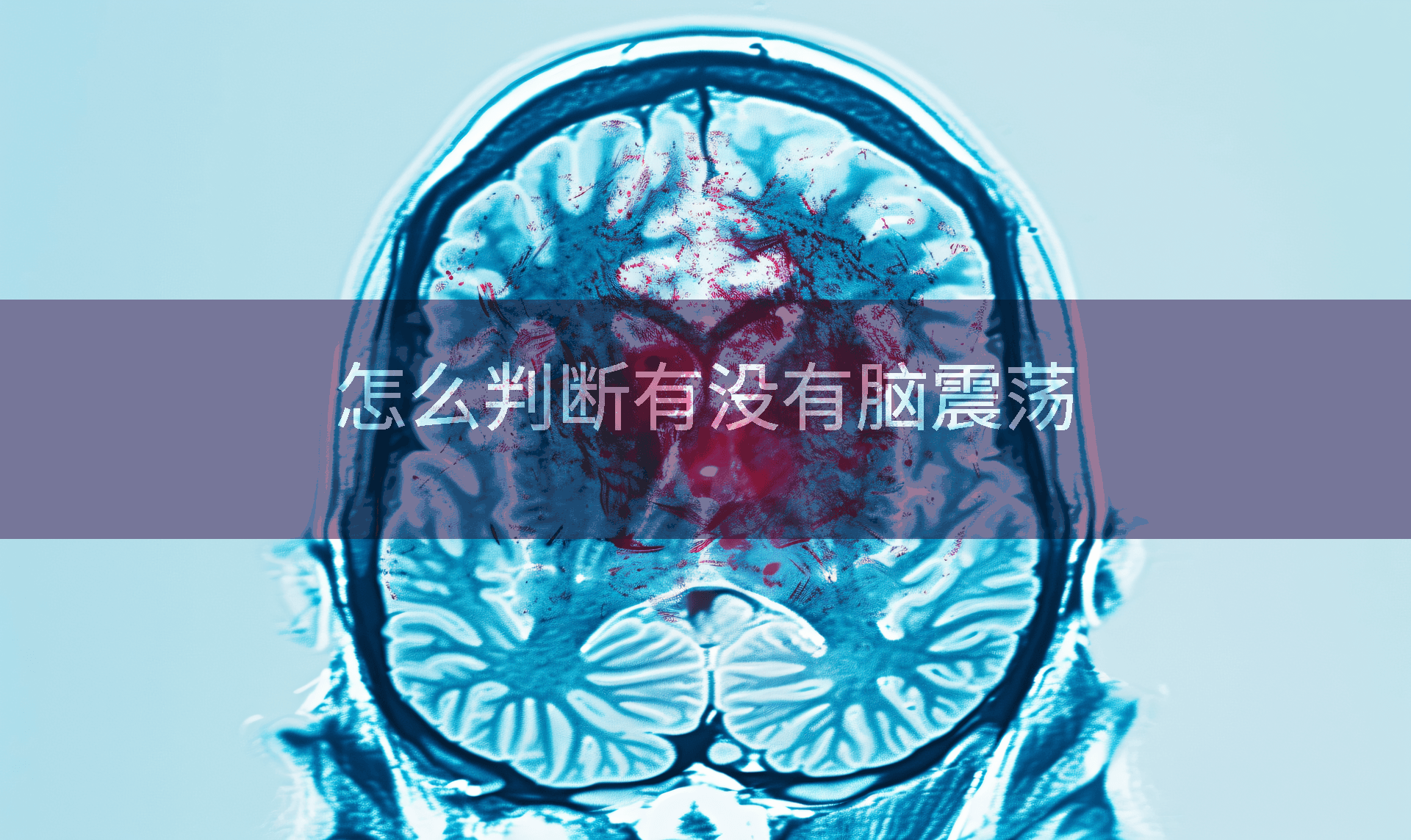 怎么判断有没有脑震荡