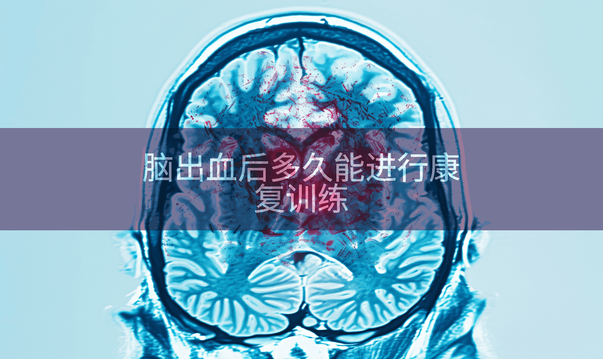 脑出血后多久能进行康复训练