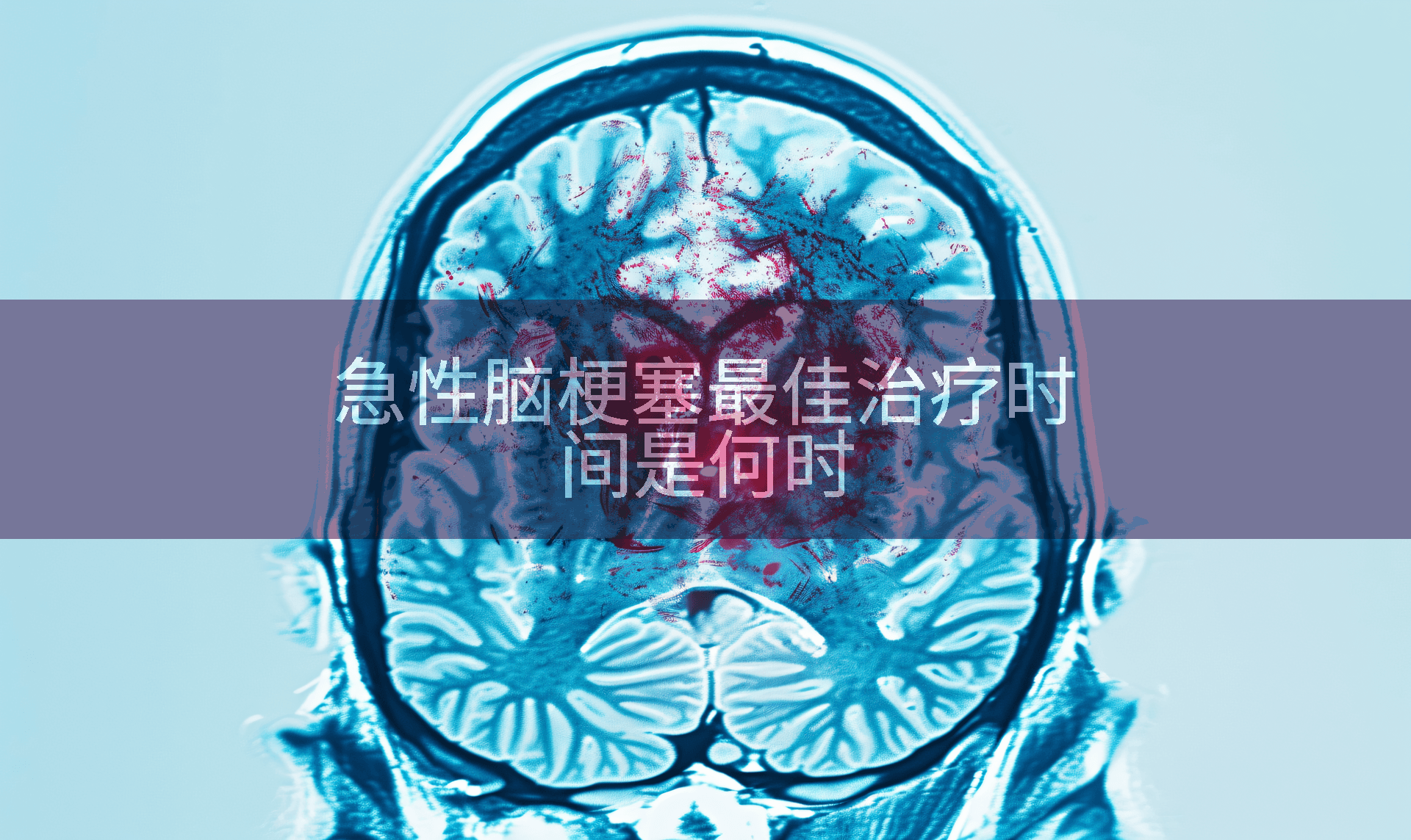 急性脑梗塞最佳治疗时间是何时