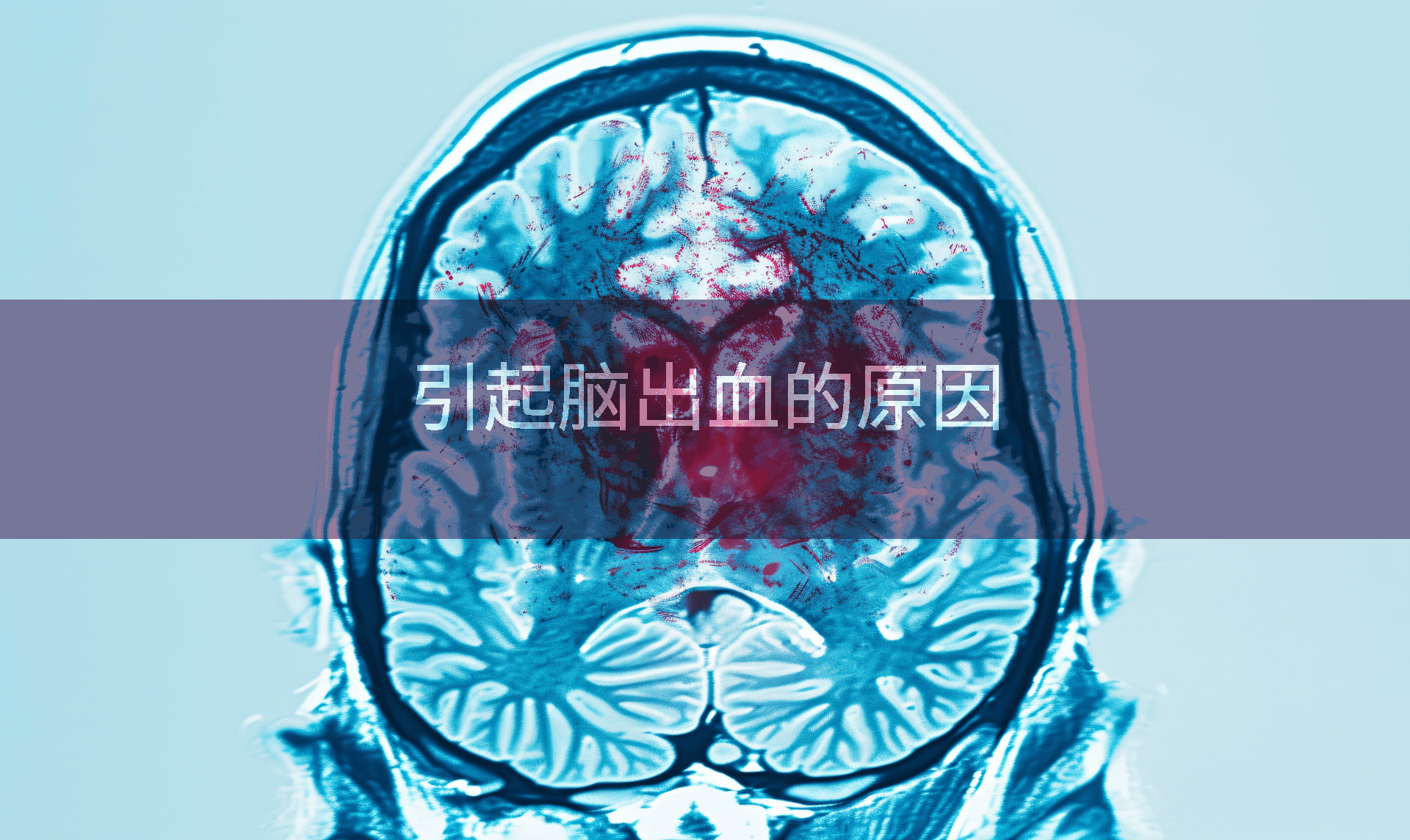 引起脑出血的原因