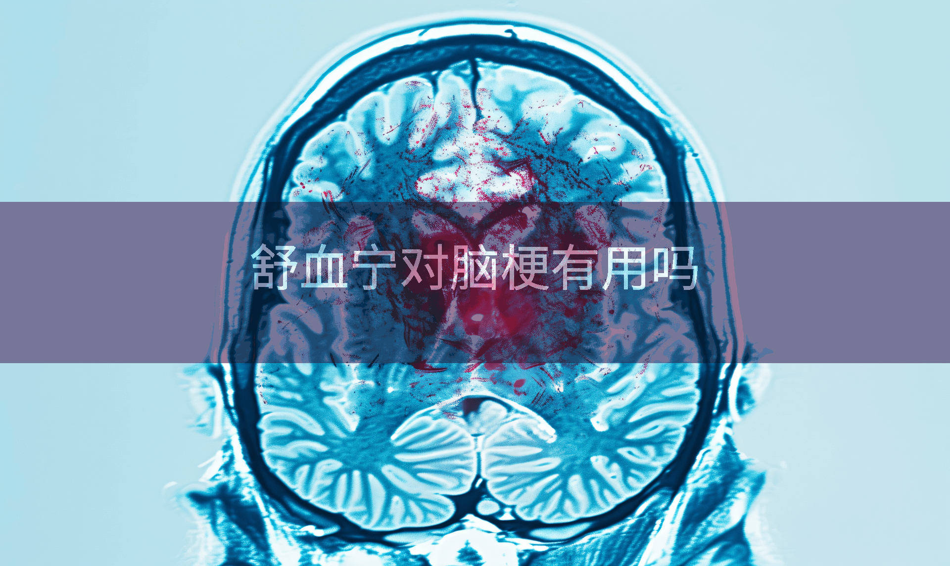 舒血宁对脑梗有用吗