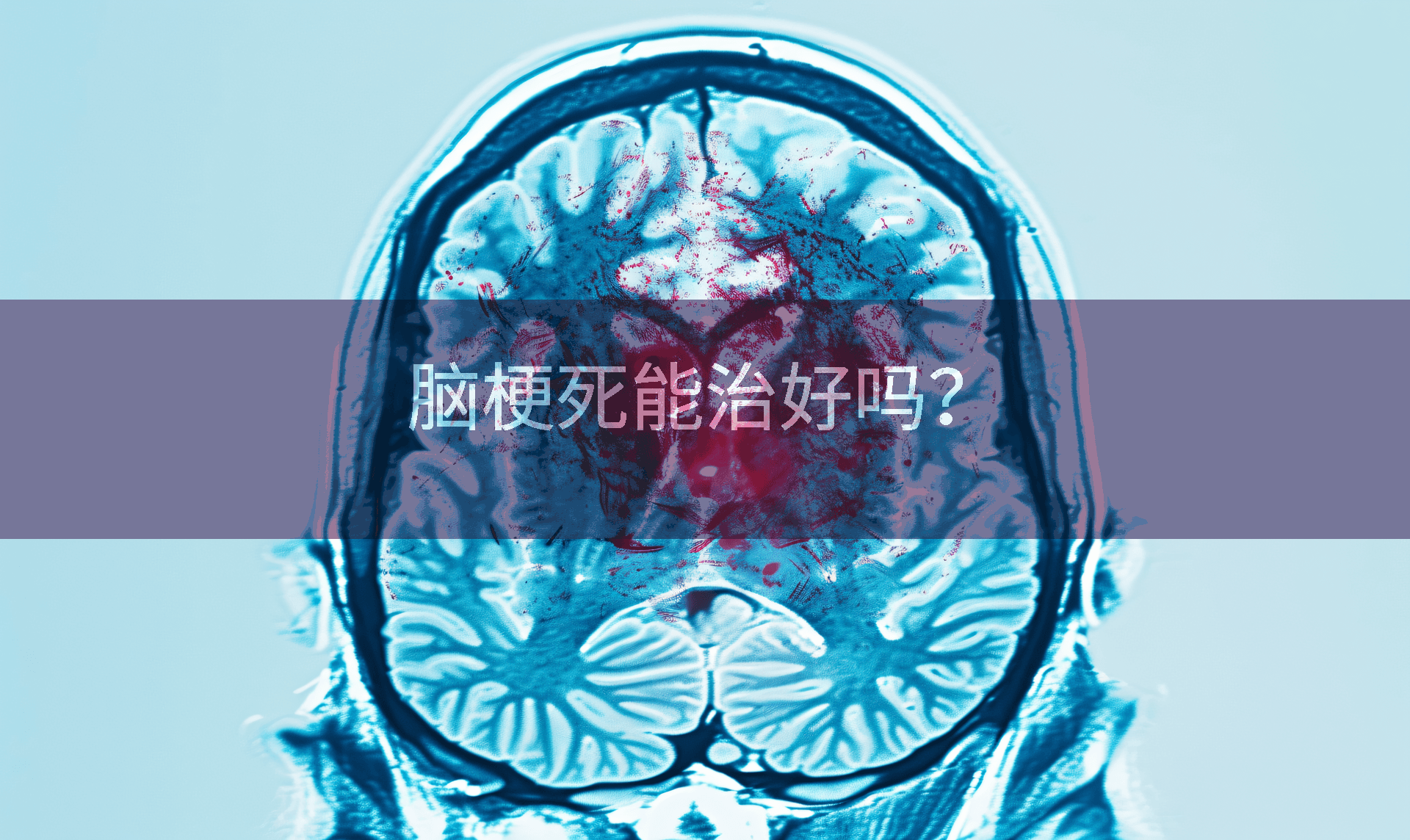 脑梗死能治好吗？