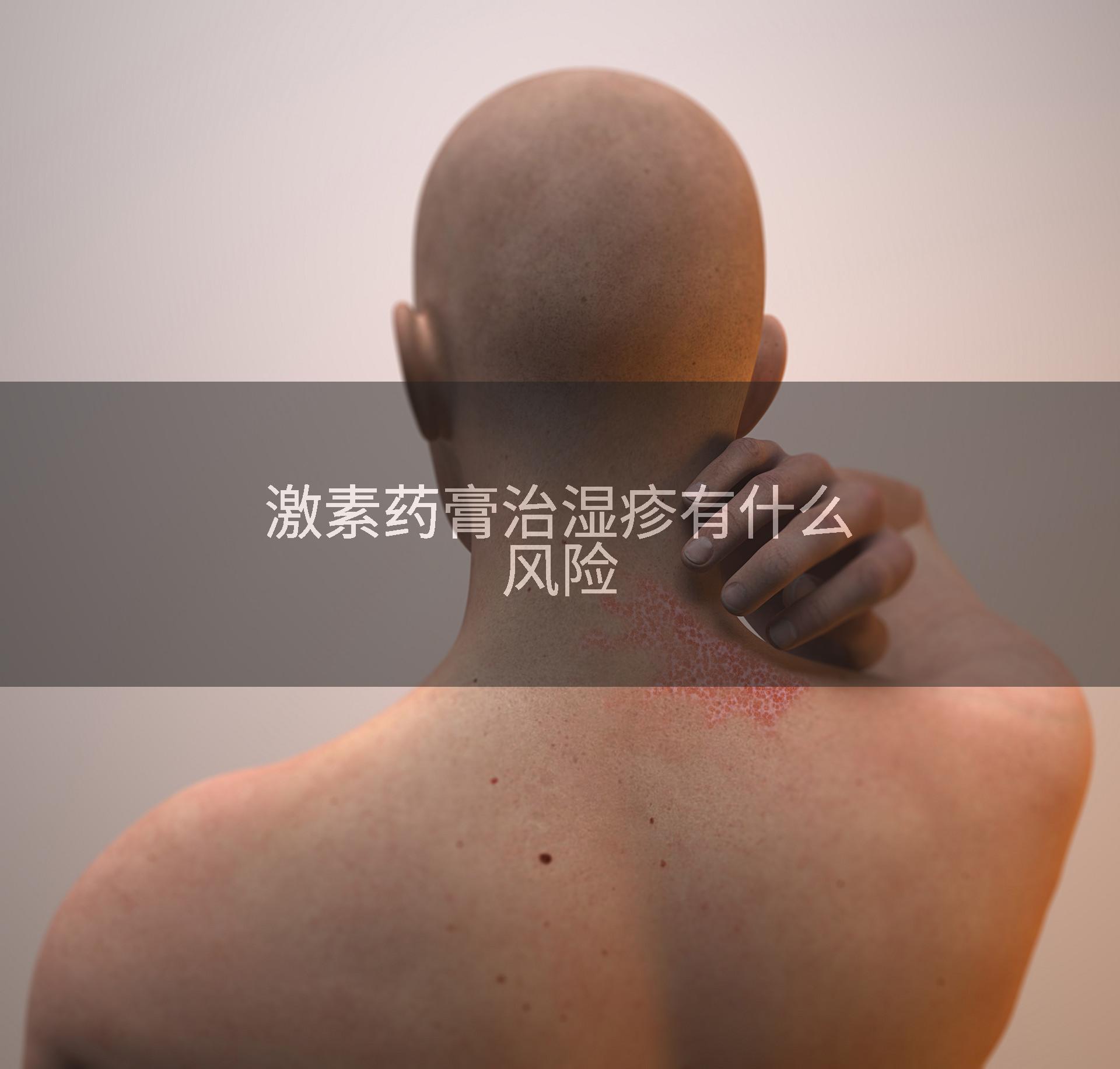激素药膏治湿疹有什么风险