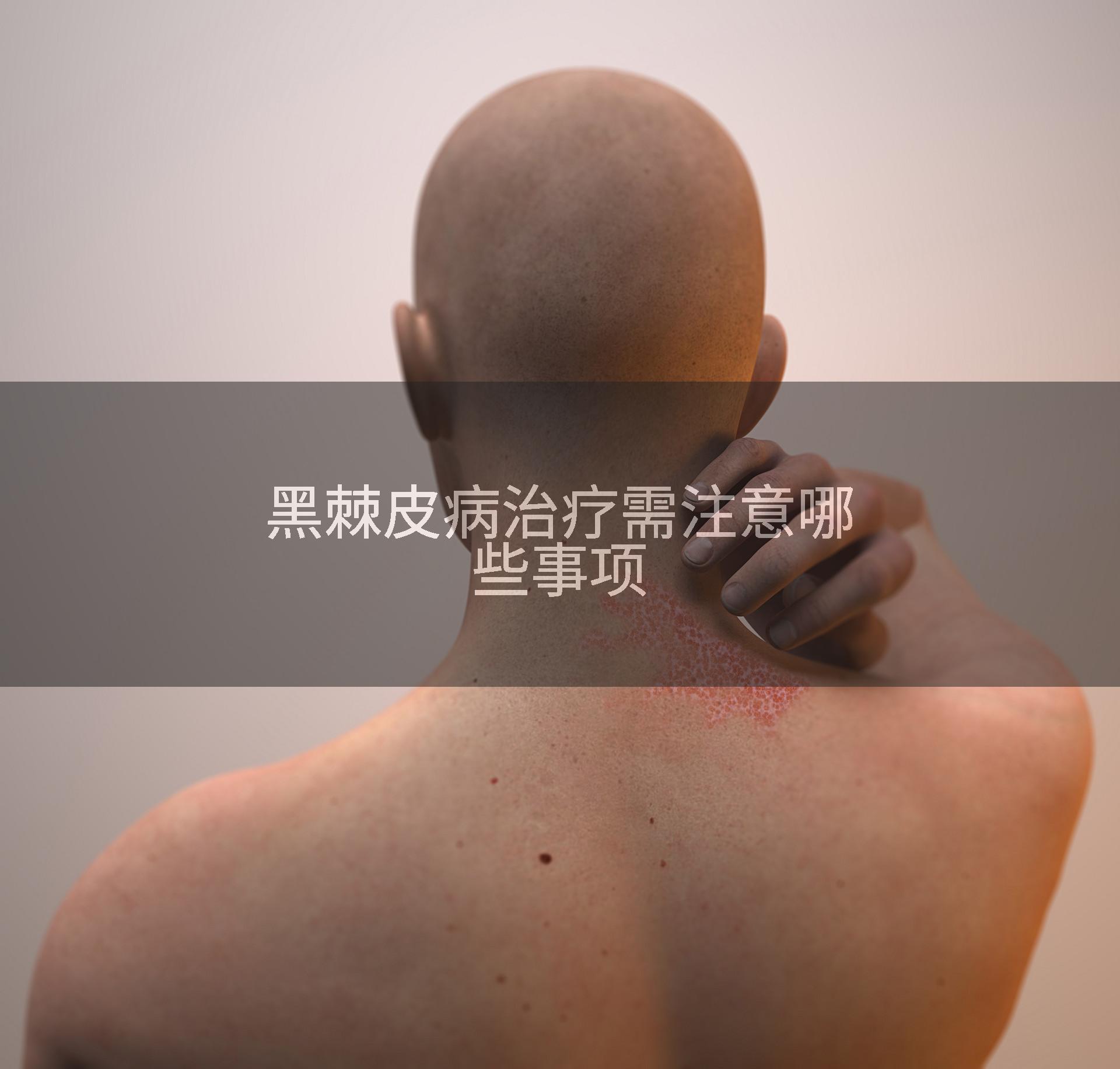 黑棘皮病治疗需注意哪些事项