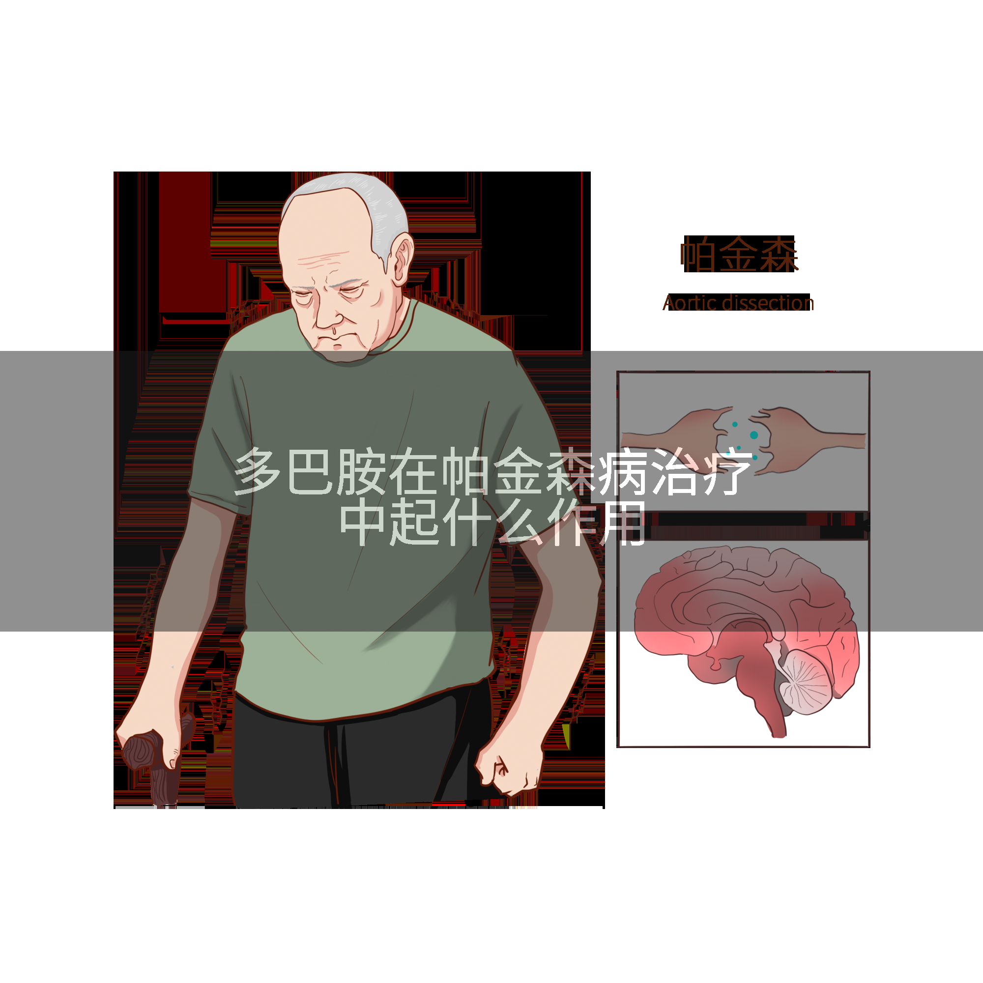 多巴胺在帕金森病治疗中起什么作用