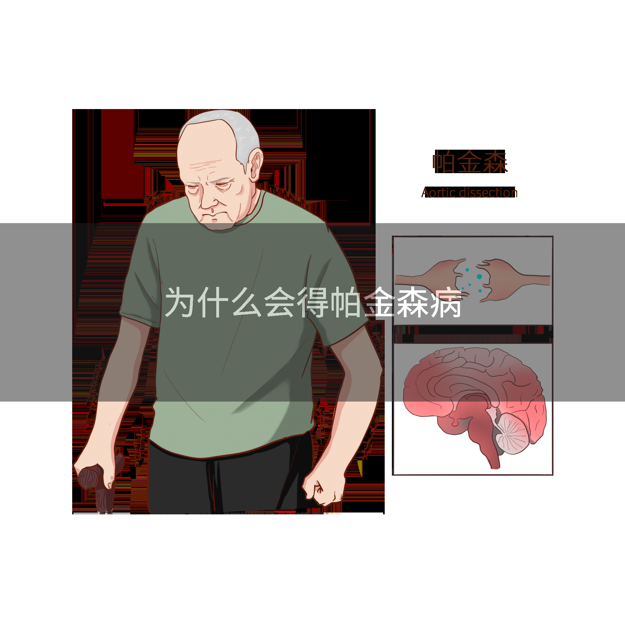 为什么会得帕金森病