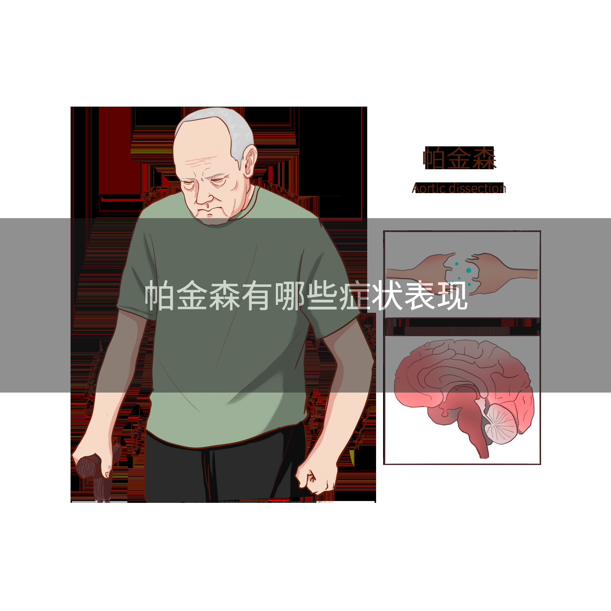 帕金森有哪些症状表现