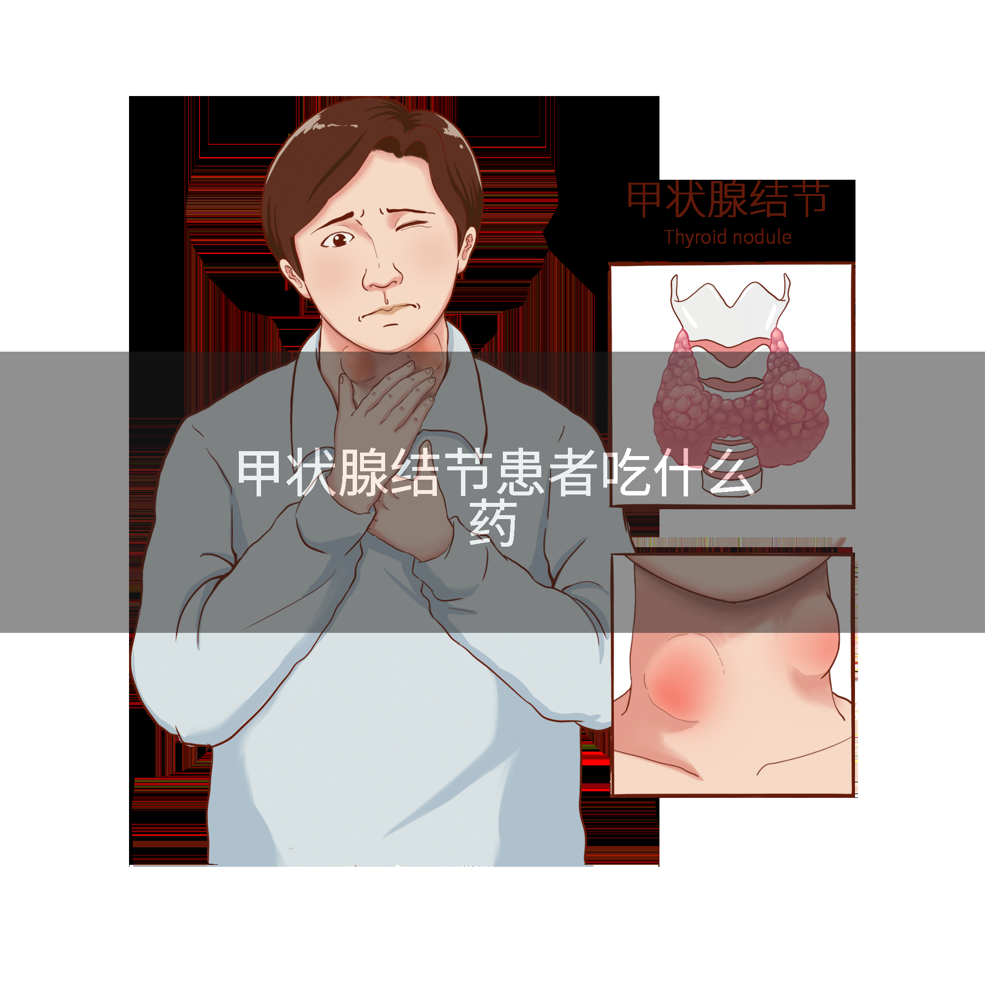 甲状腺结节患者吃什么药
