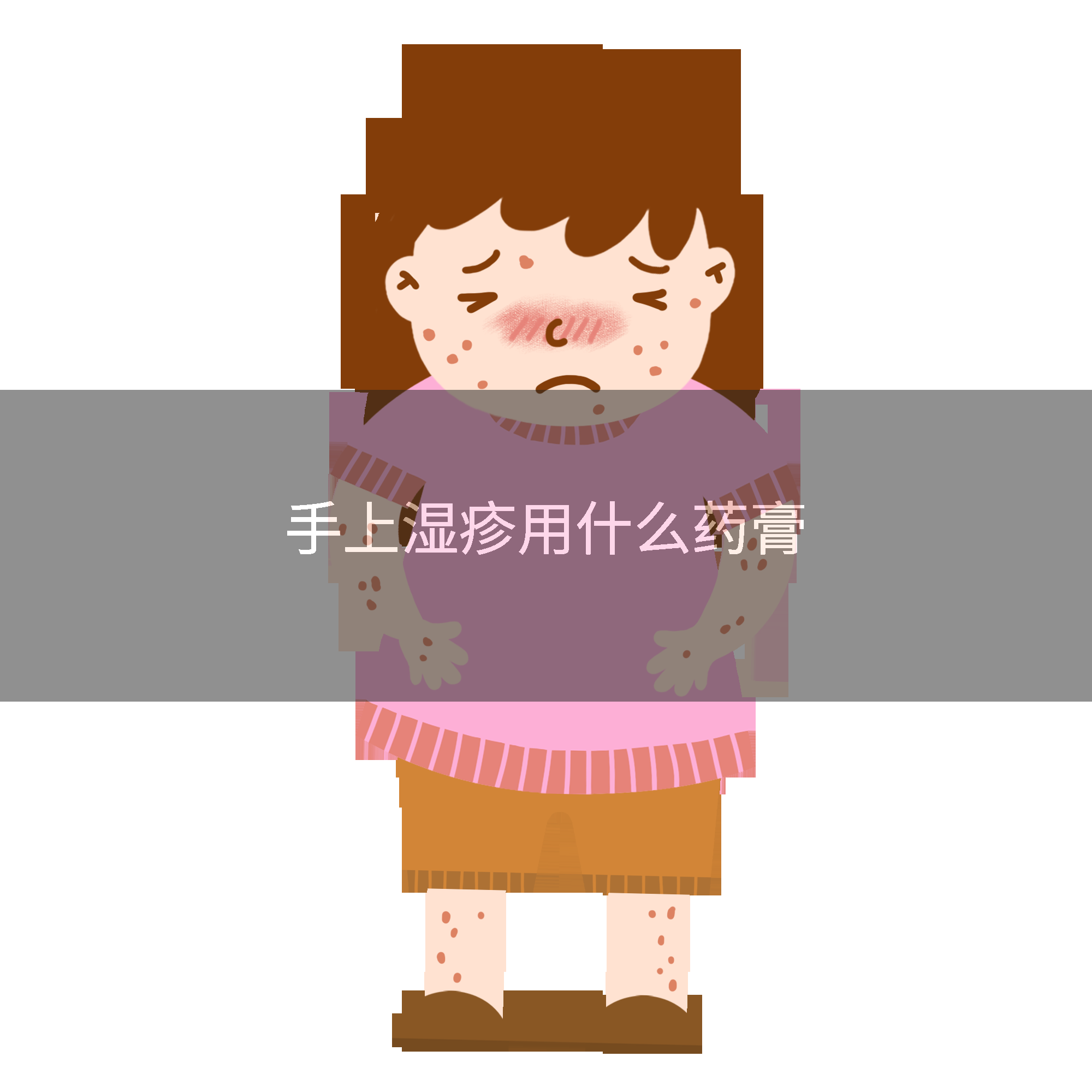 手上湿疹用什么药膏