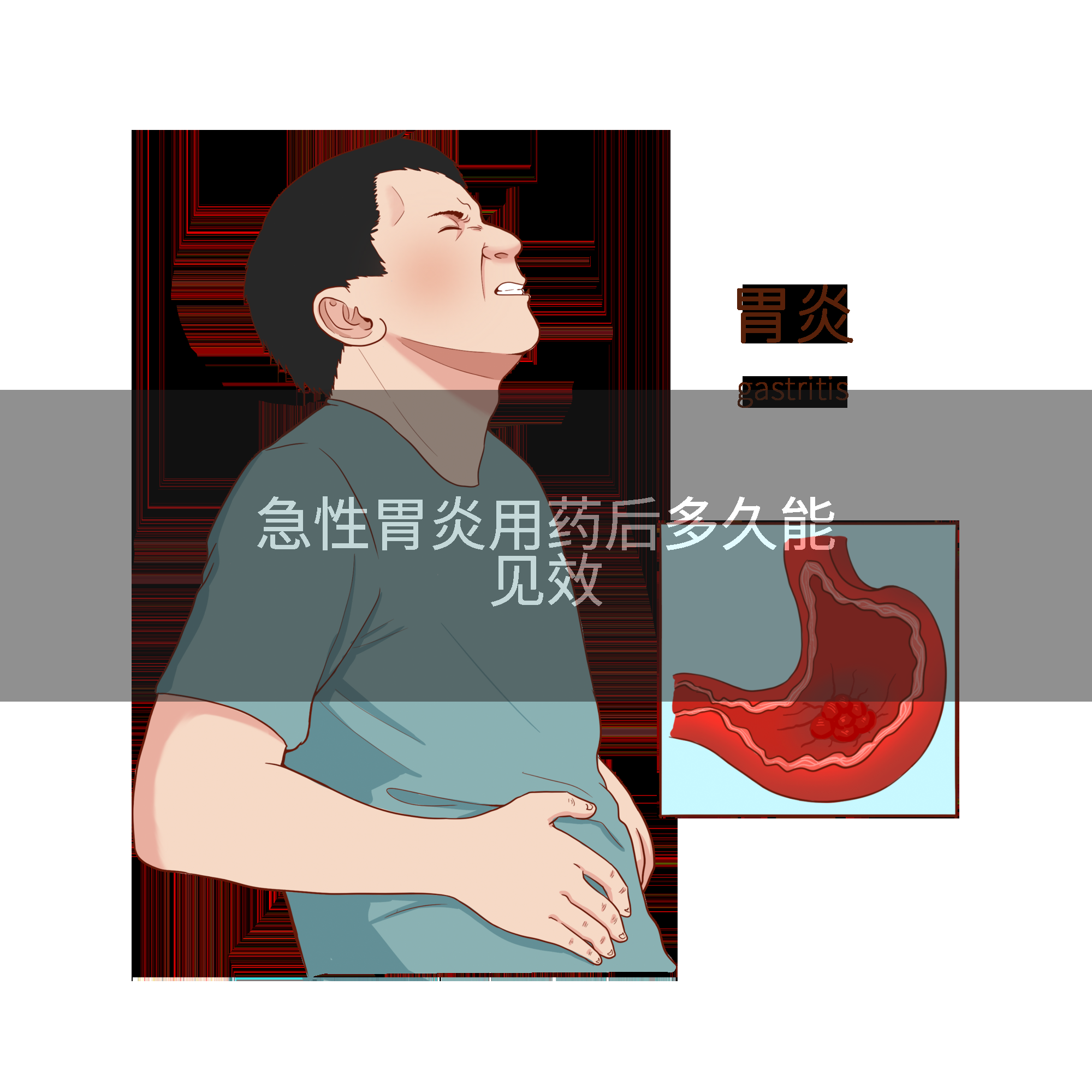 急性胃炎用药后多久能见效