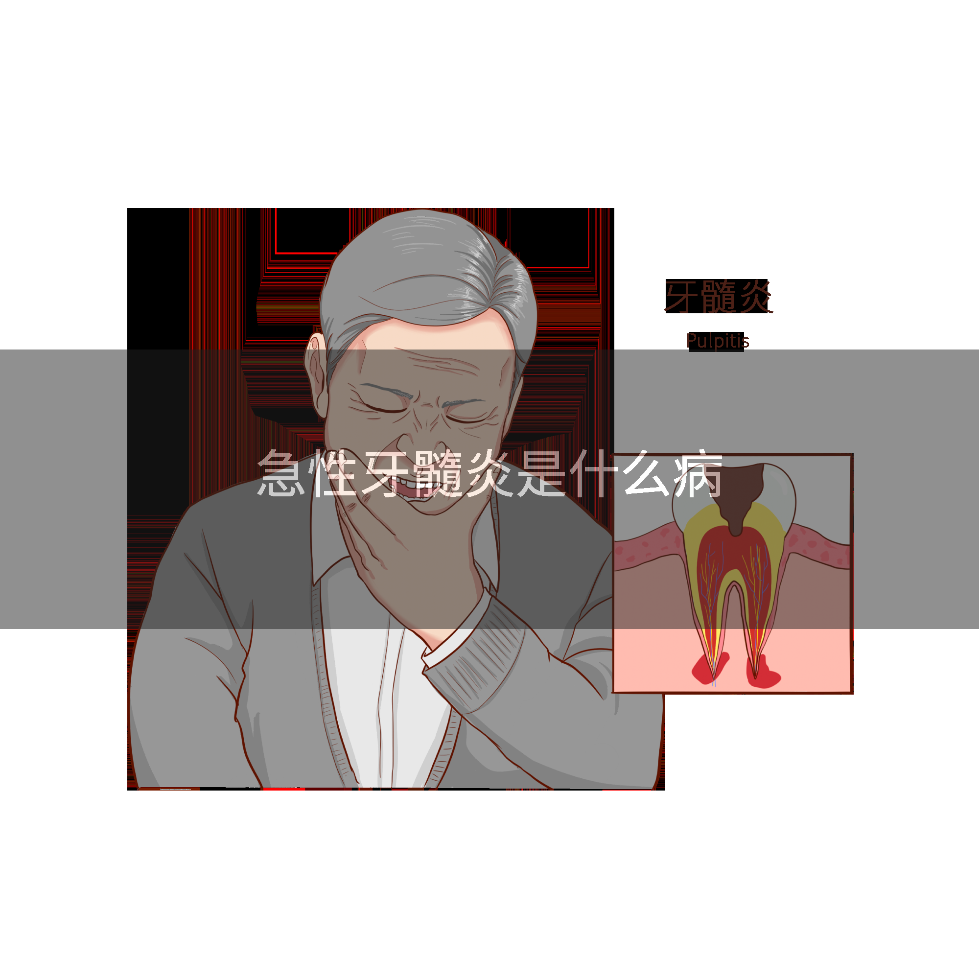 急性牙髓炎是什么病