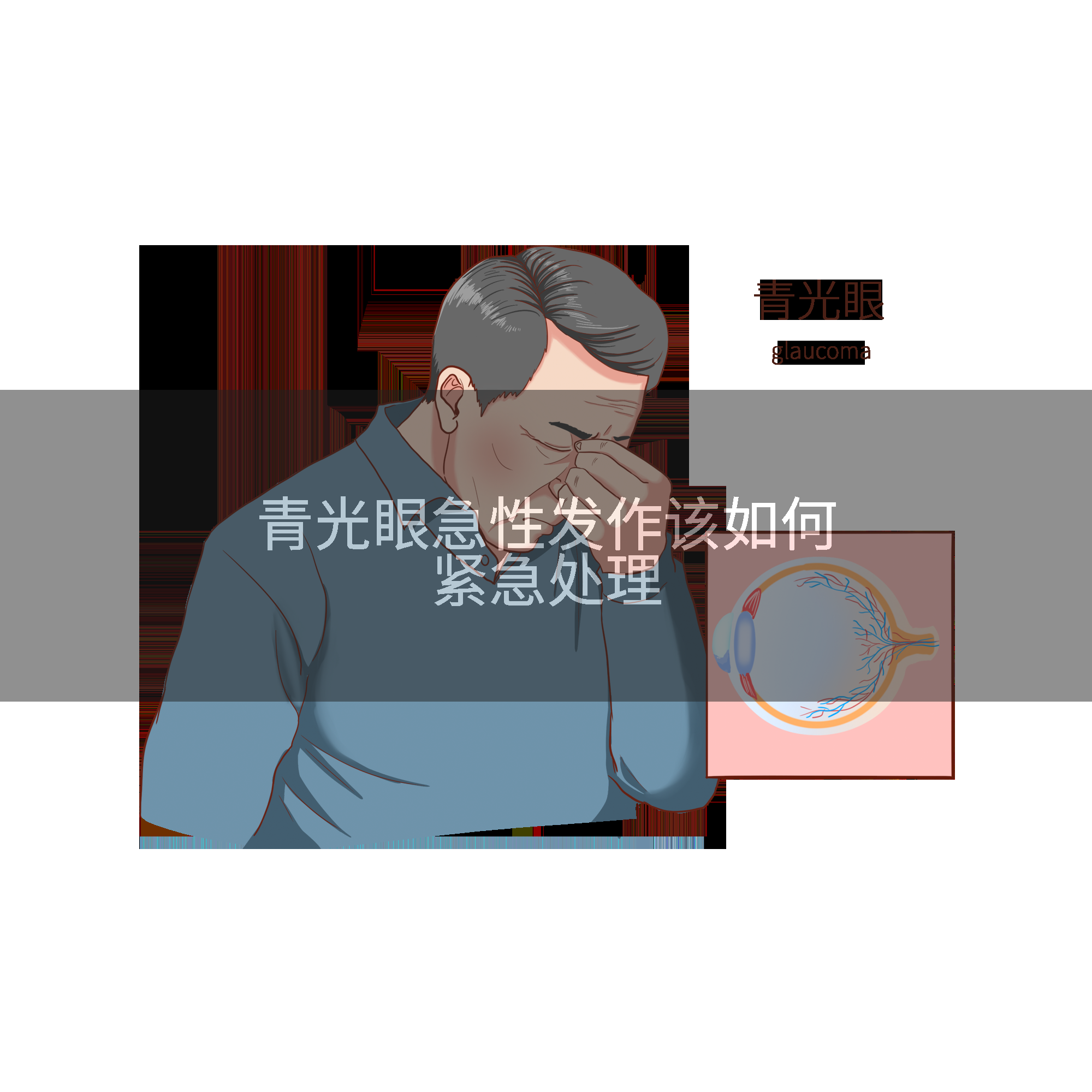 青光眼急性发作该如何紧急处理