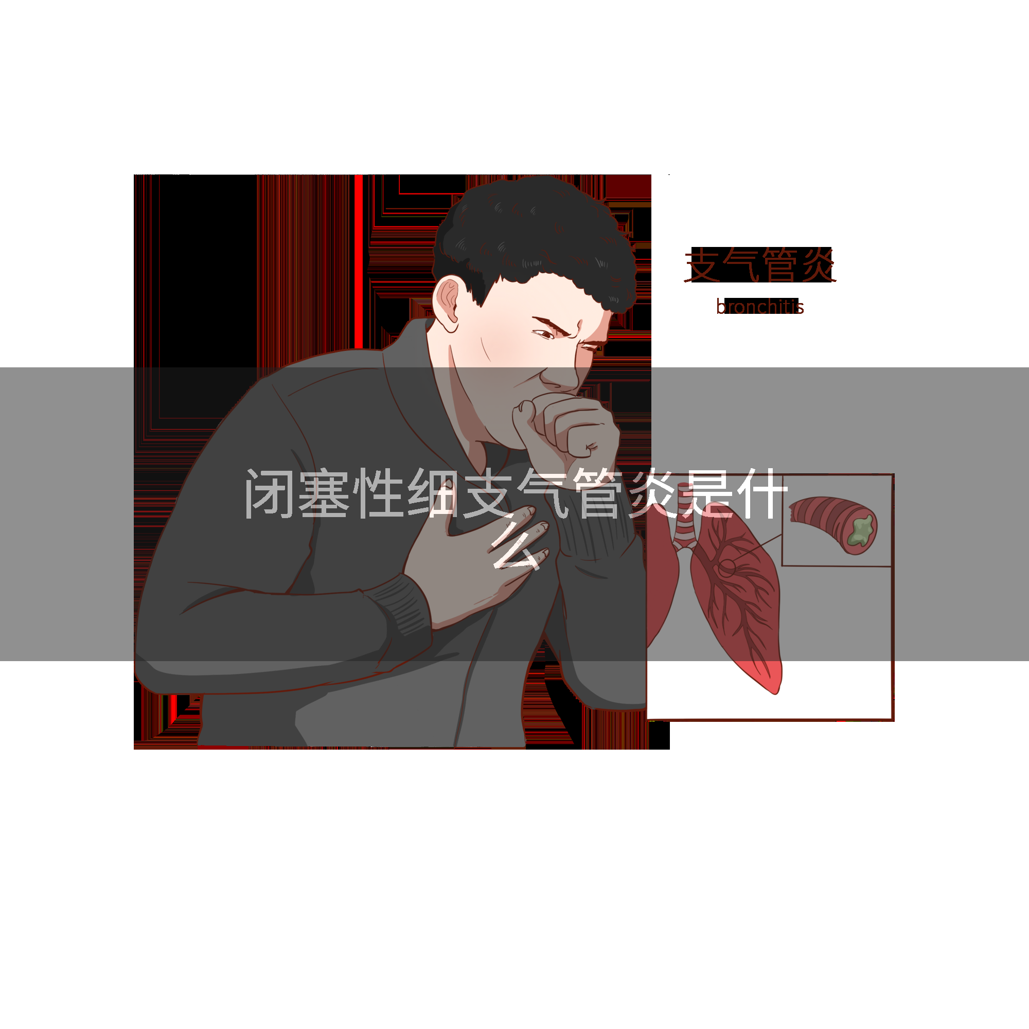 闭塞性细支气管炎是什么