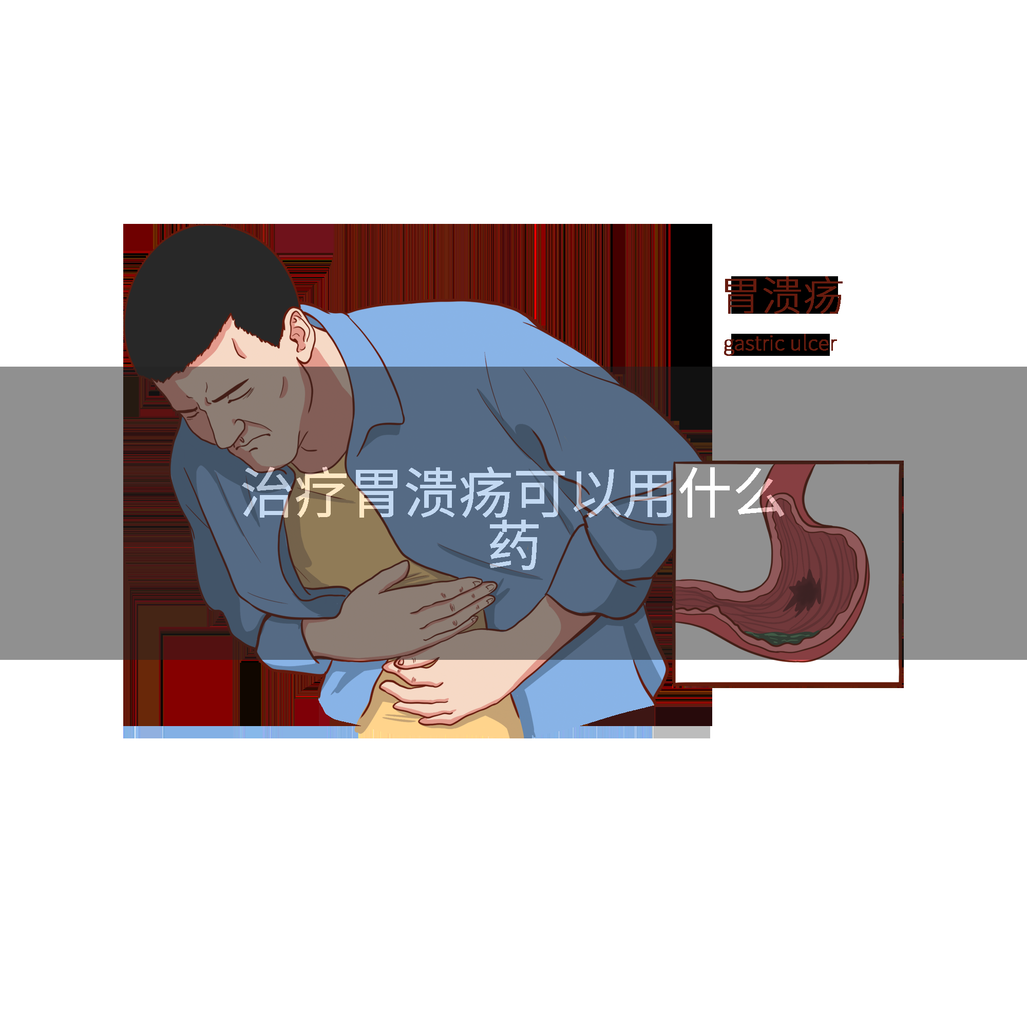 治疗胃溃疡可以用什么药