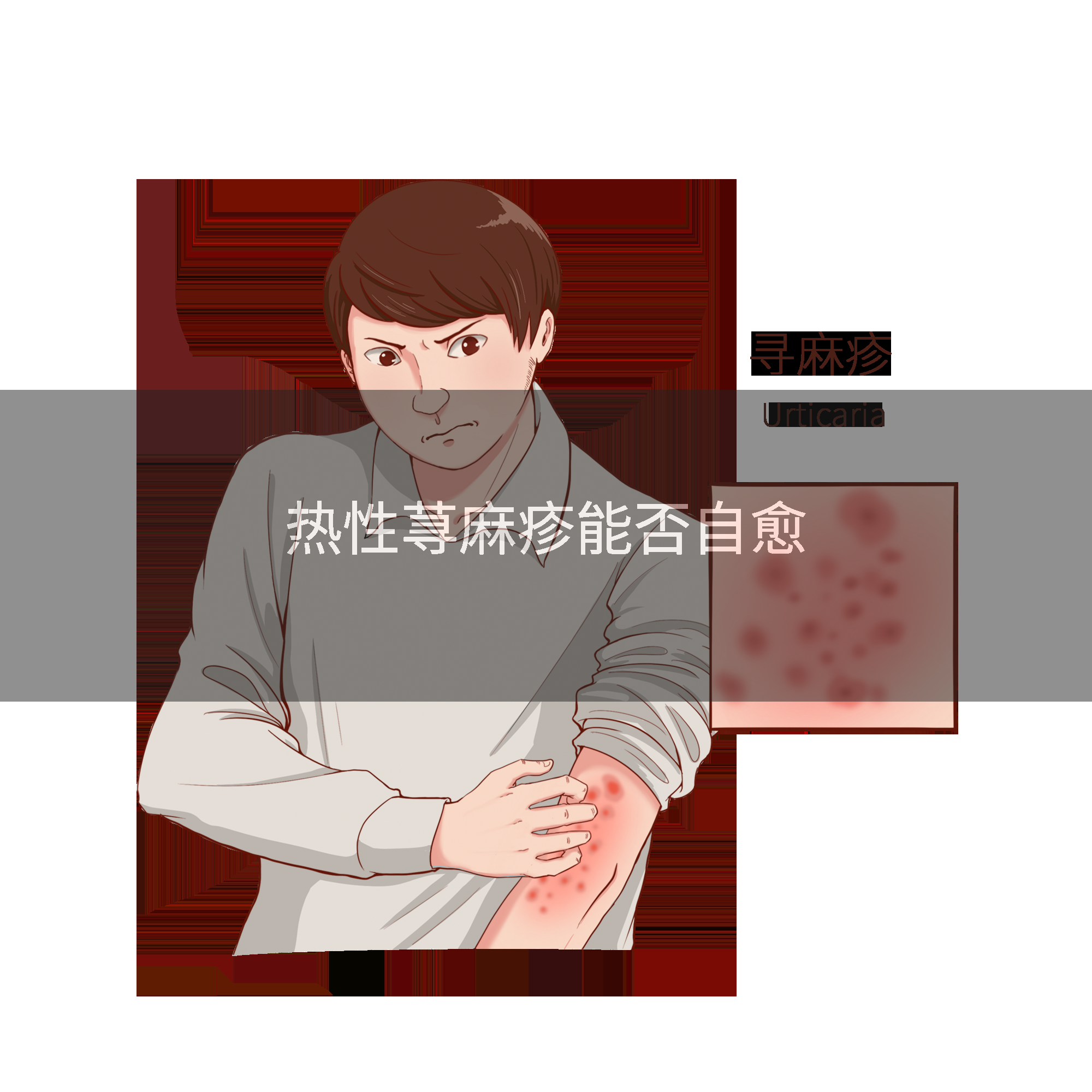 热性荨麻疹能否自愈