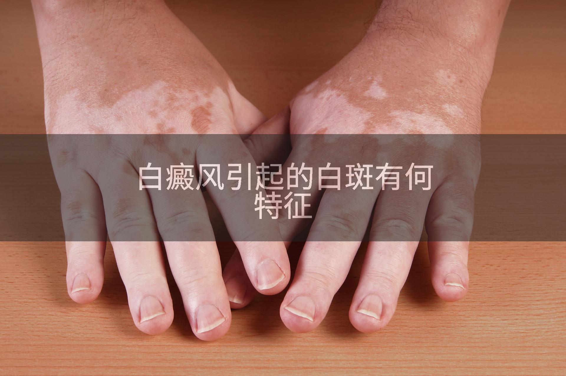 白癜风引起的白斑有何特征