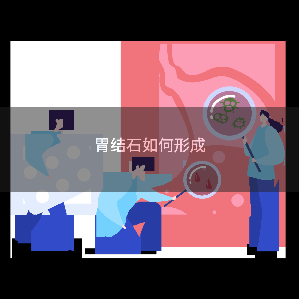 胃结石如何形成