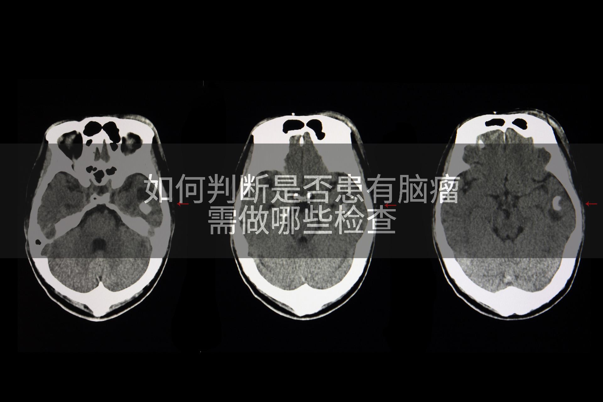 如何判断是否患有脑瘤需做哪些检查