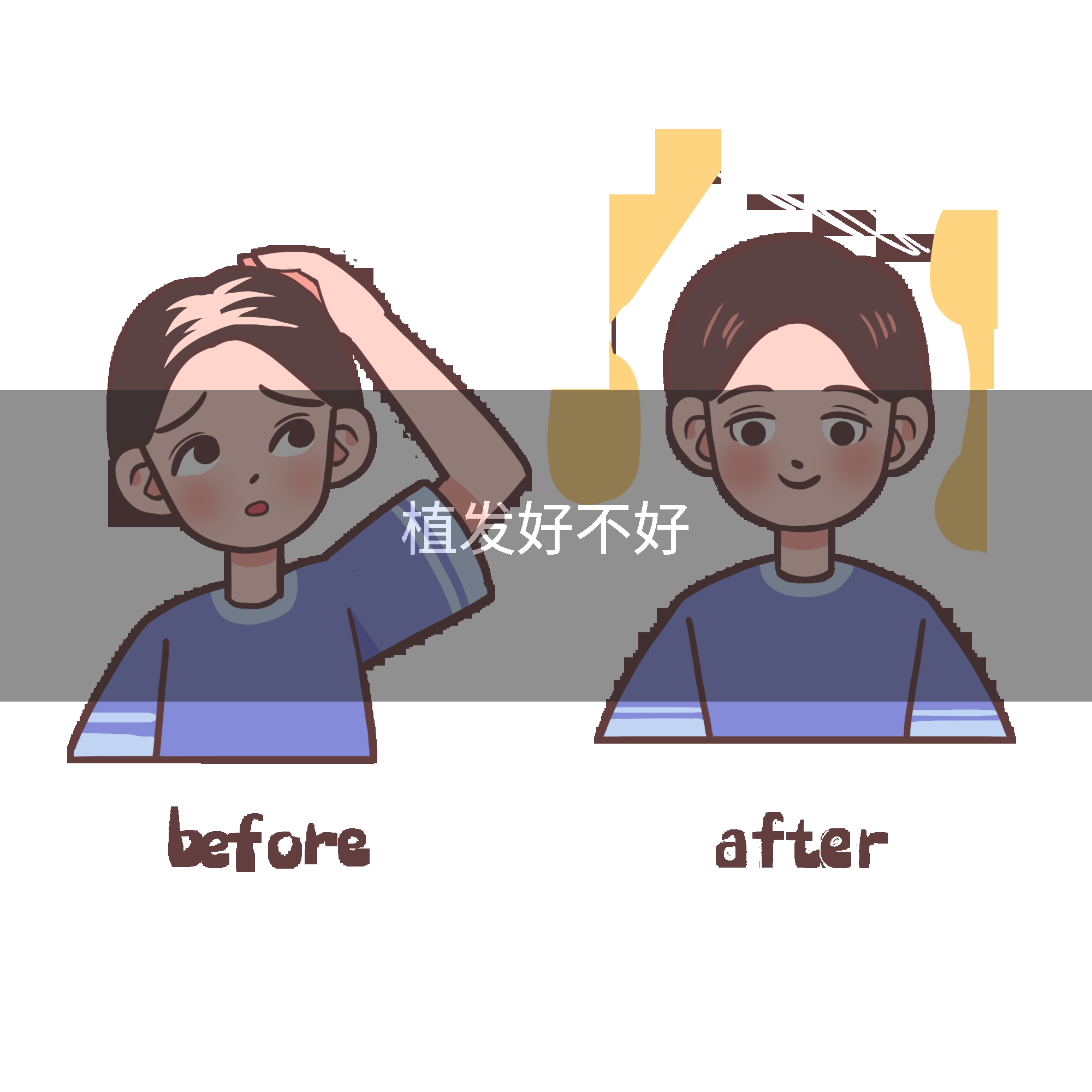 植发好不好
