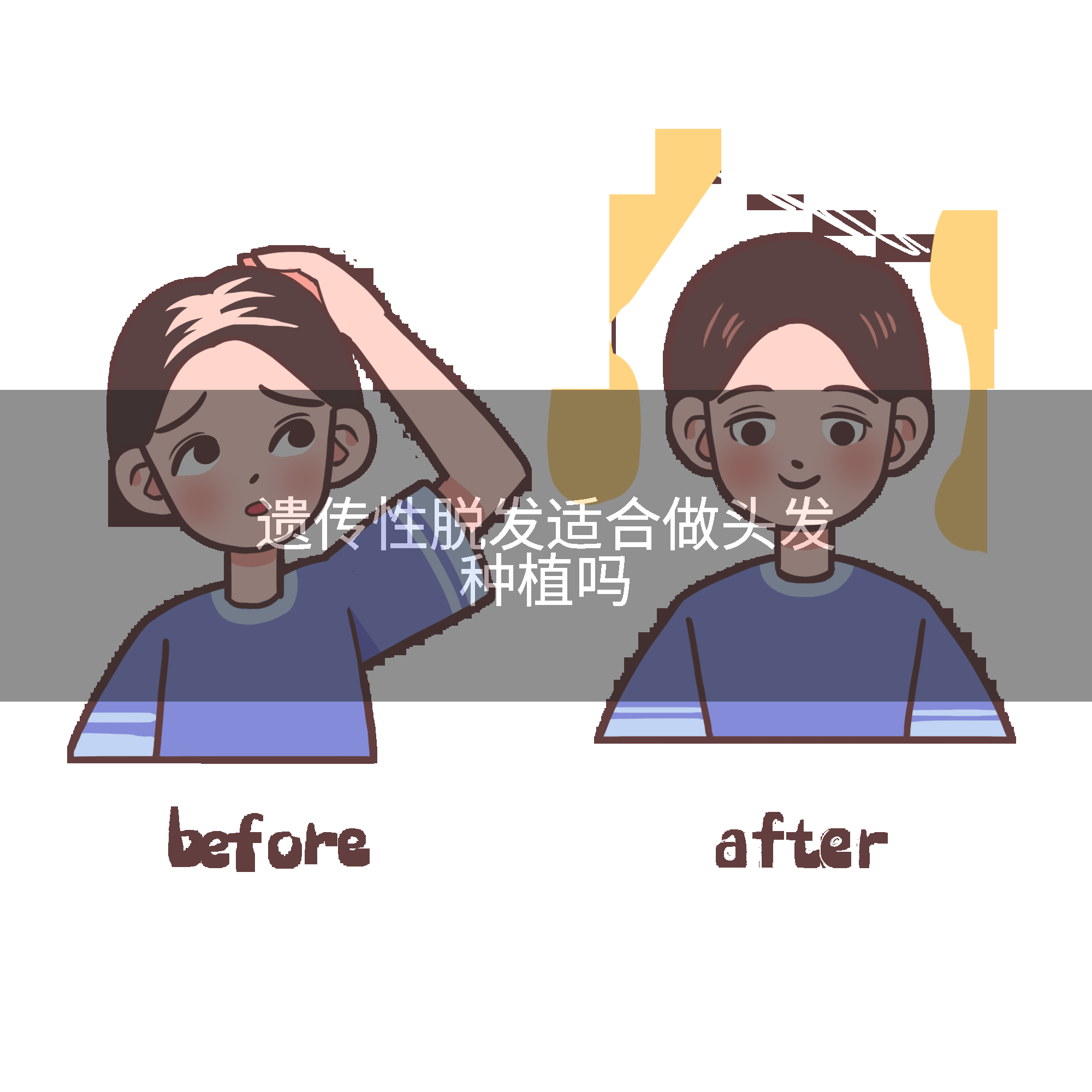 遗传性脱发适合做头发种植吗
