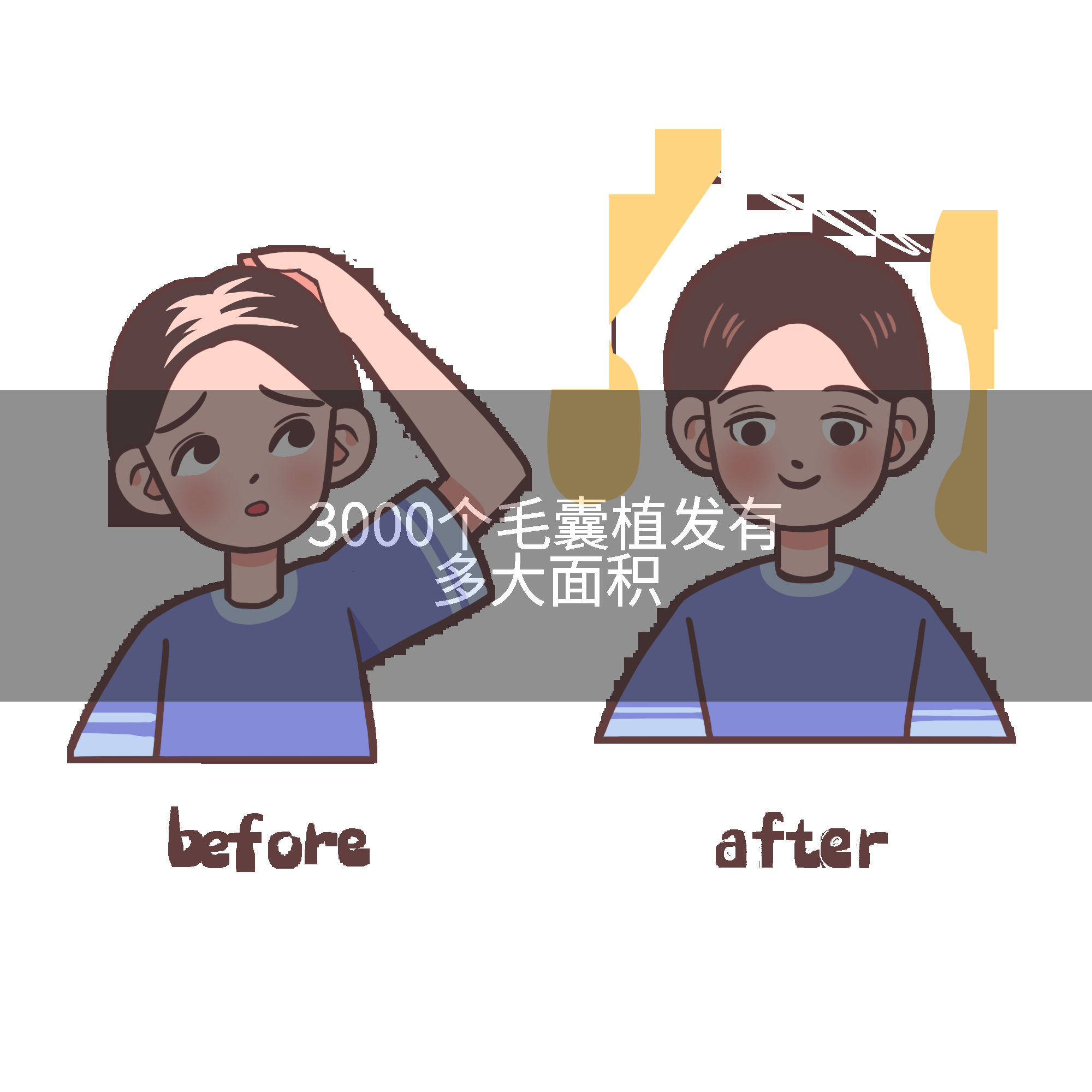 3000个毛囊植发有多大面积