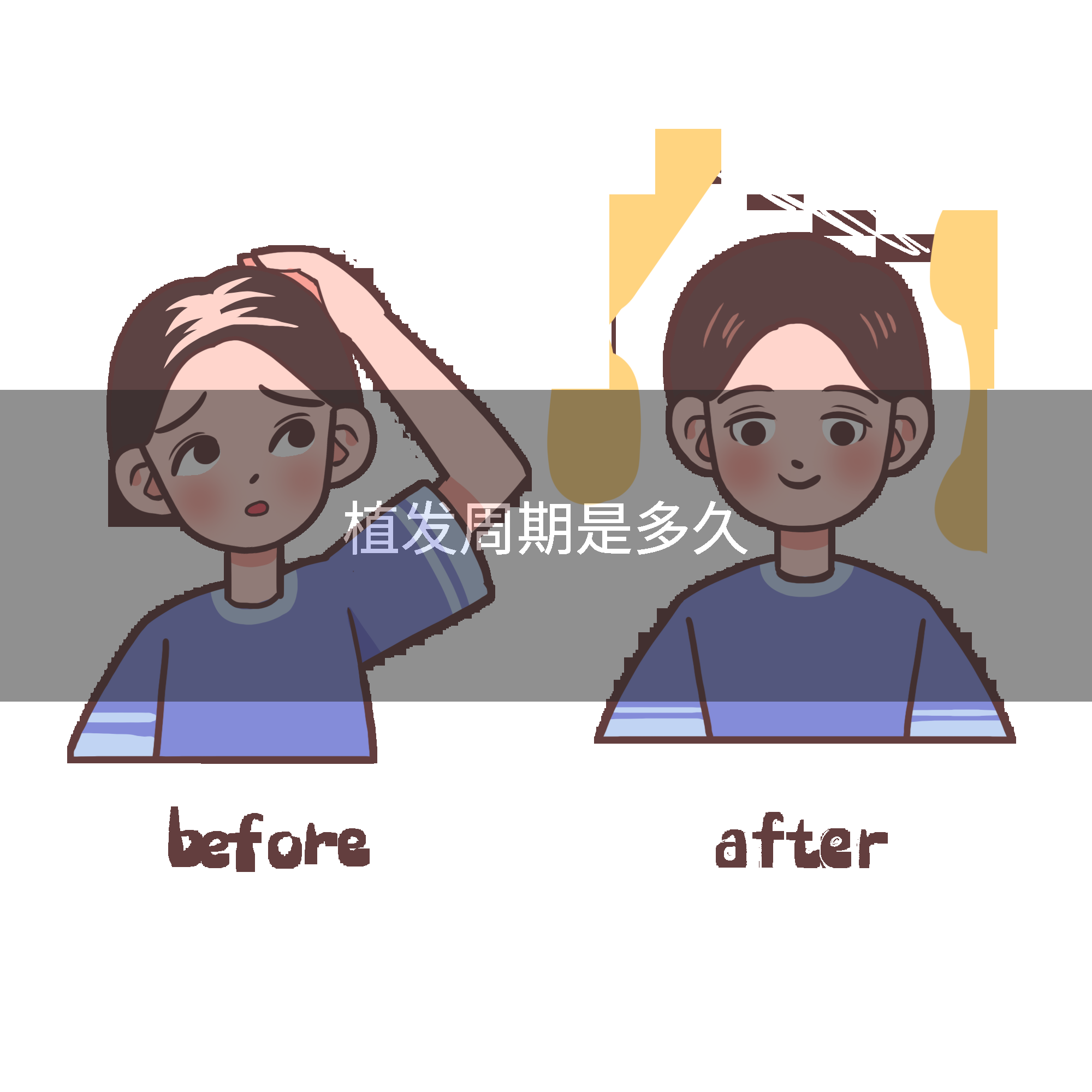 植发周期是多久