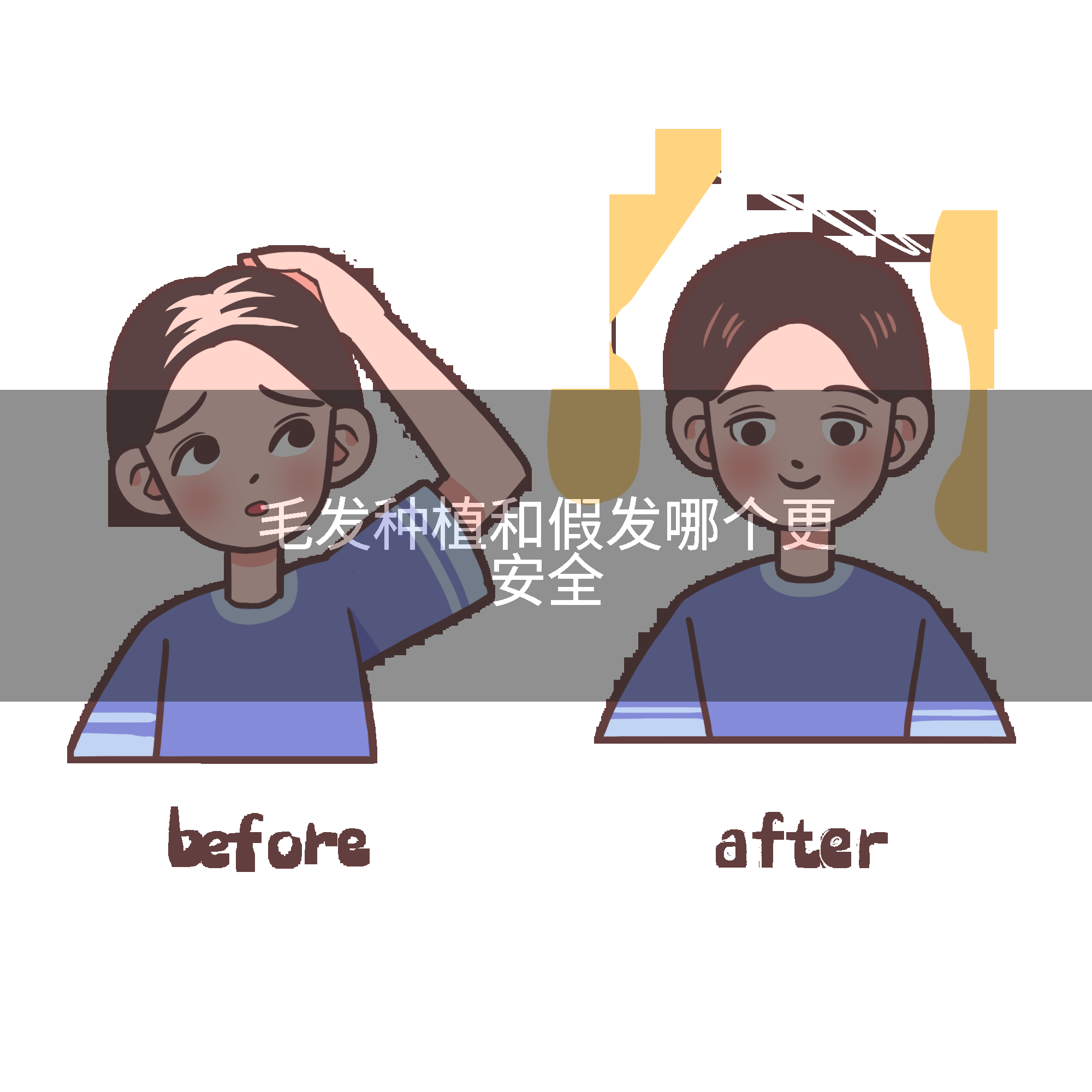 毛发种植和假发哪个更安全