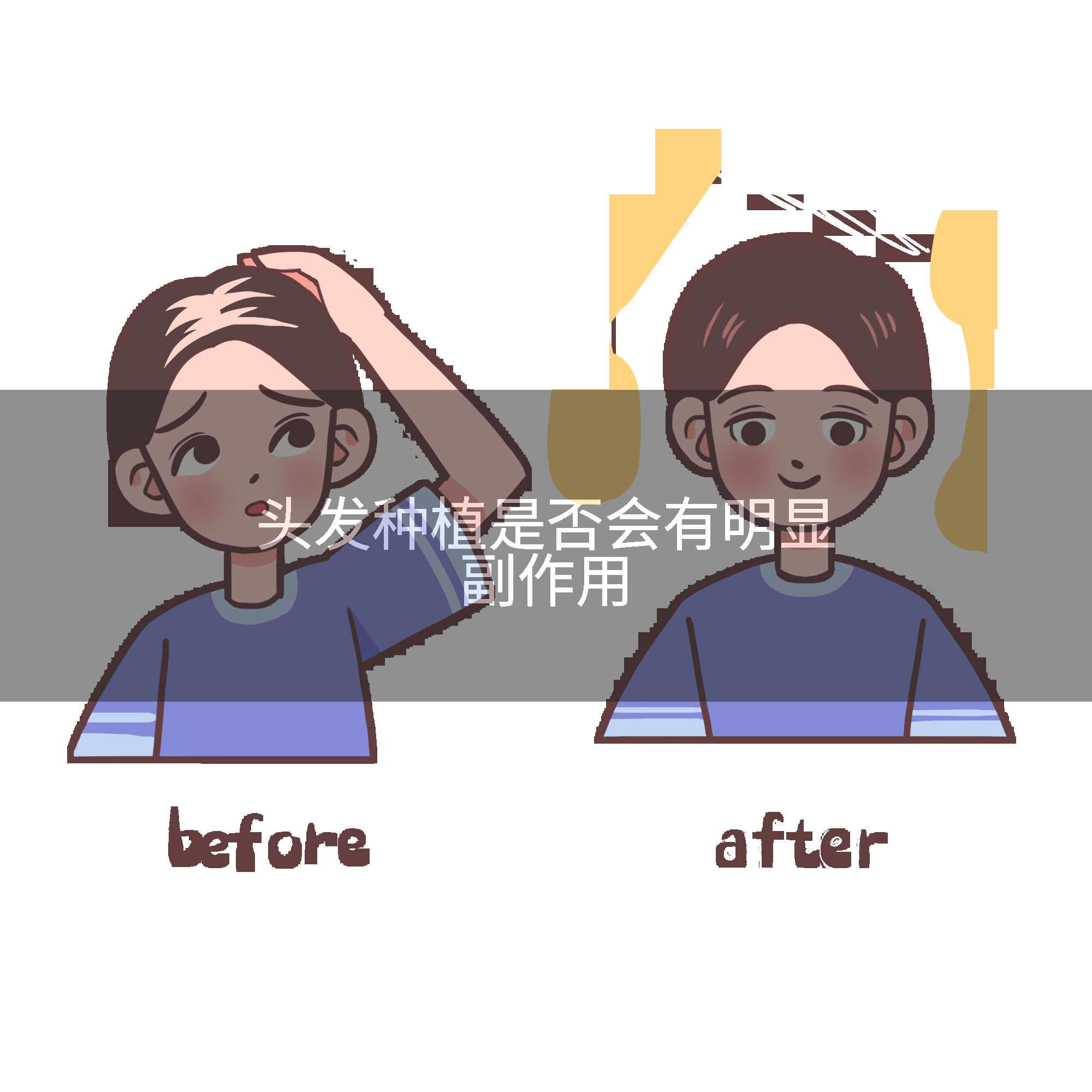 头发种植是否会有明显副作用