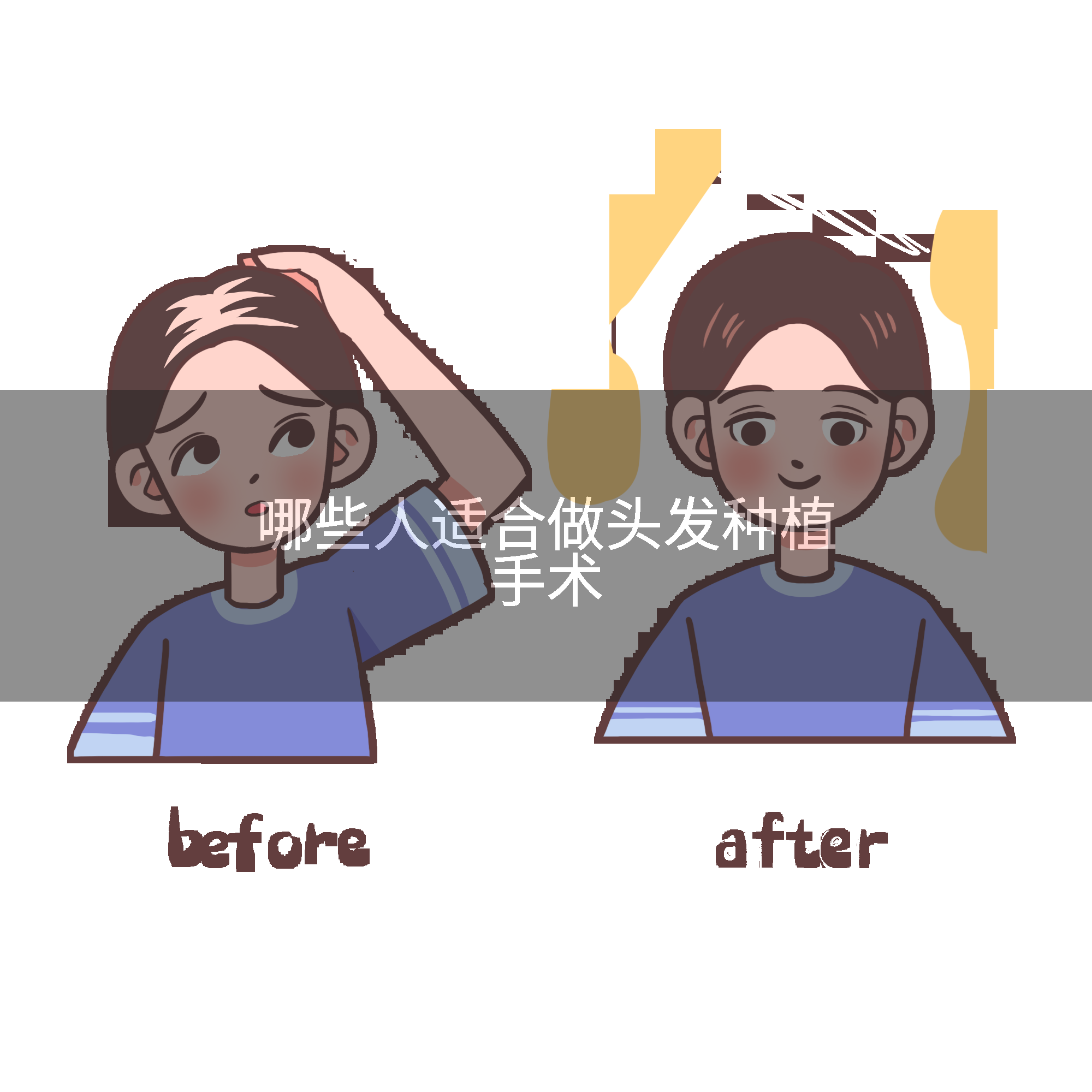 哪些人适合做头发种植手术