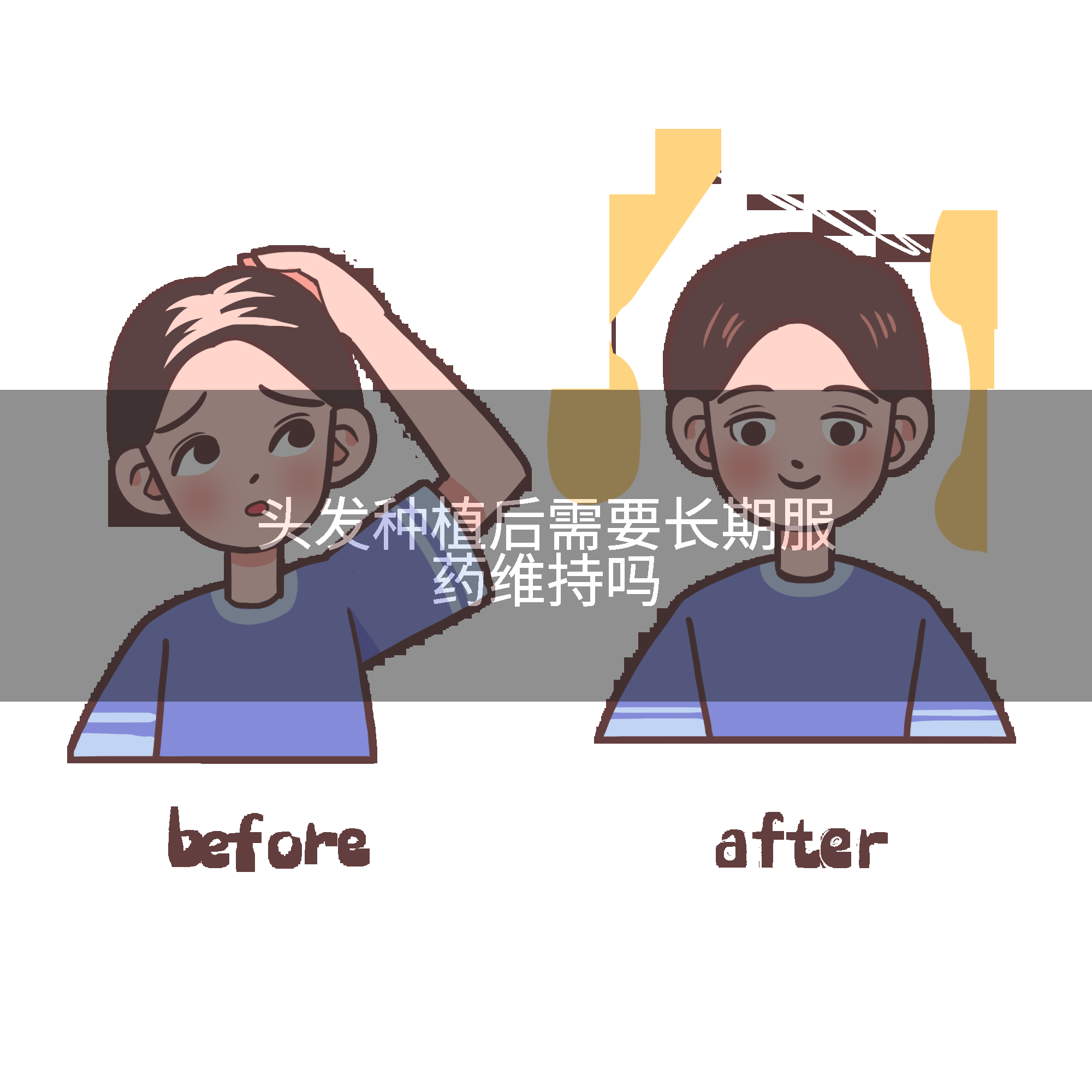 头发种植后需要长期服药维持吗