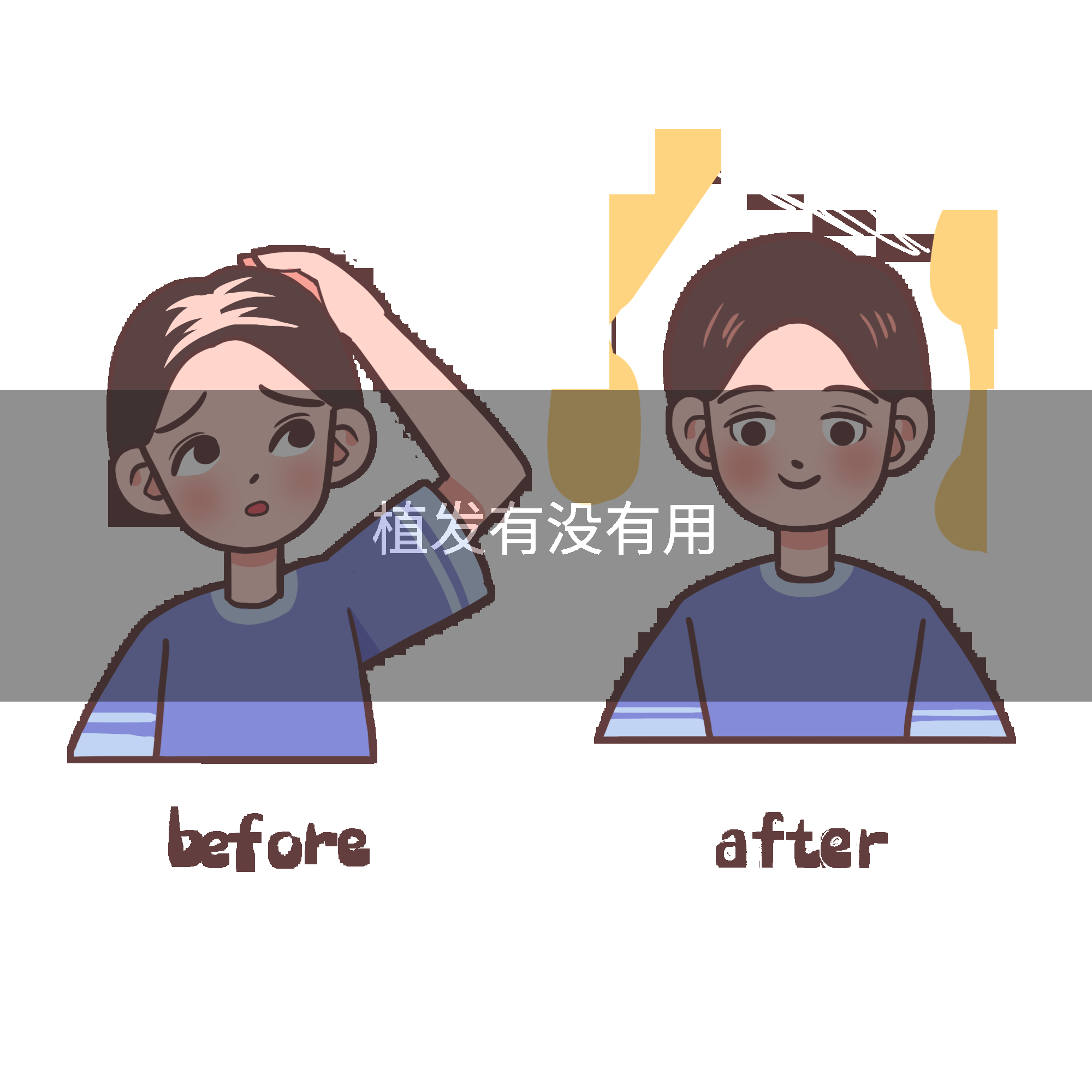 植发有没有用