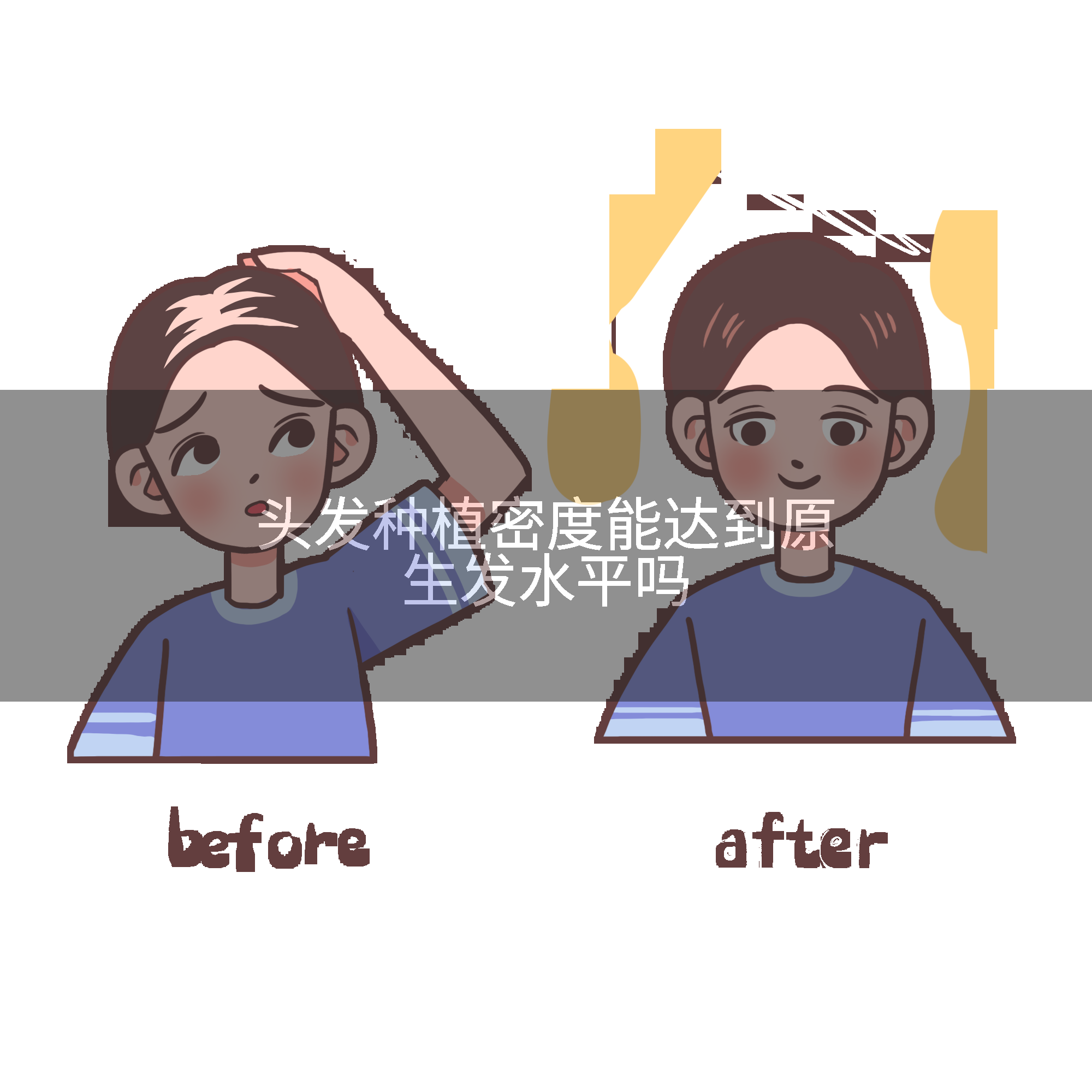 头发种植密度能达到原生发水平吗